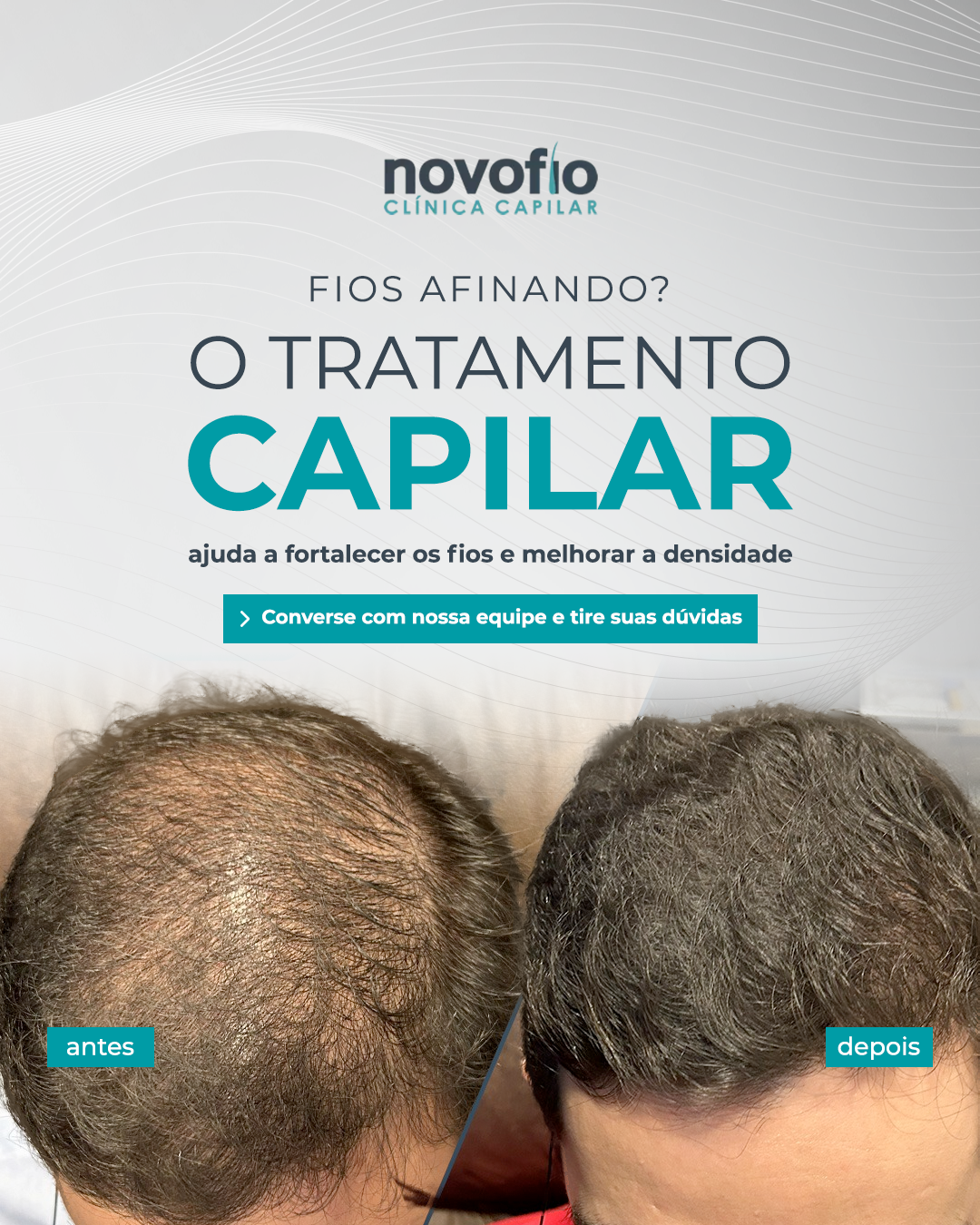 Novofio Bauru Clínica Capilar Facebook ad