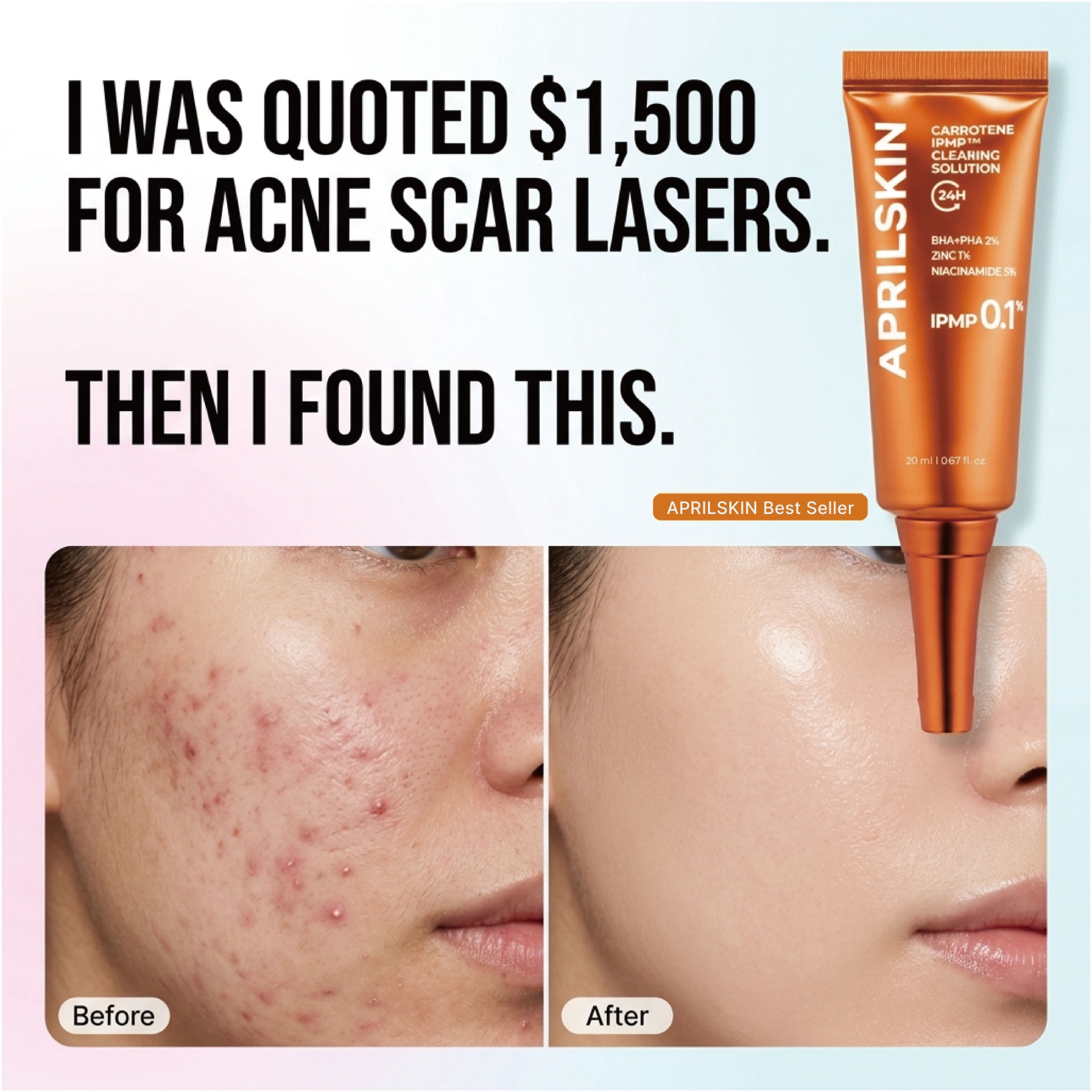 APRILSKIN Facebook ad