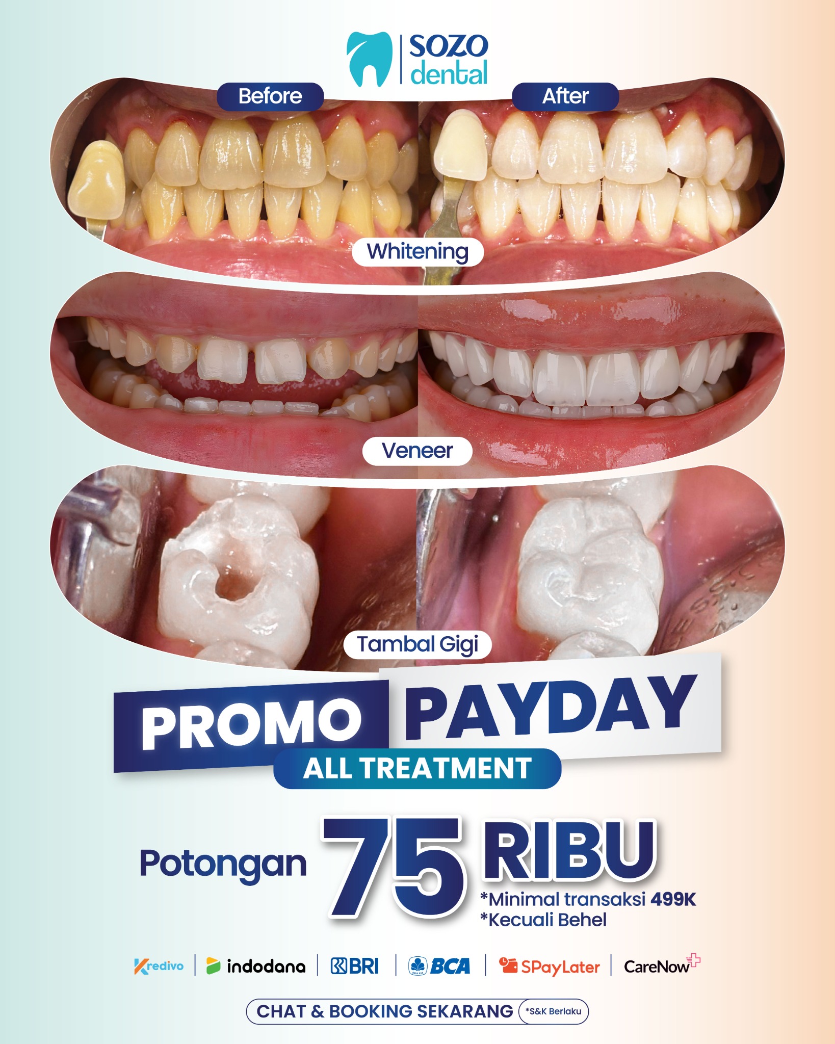 Sozo Dental Clinic Facebook ad