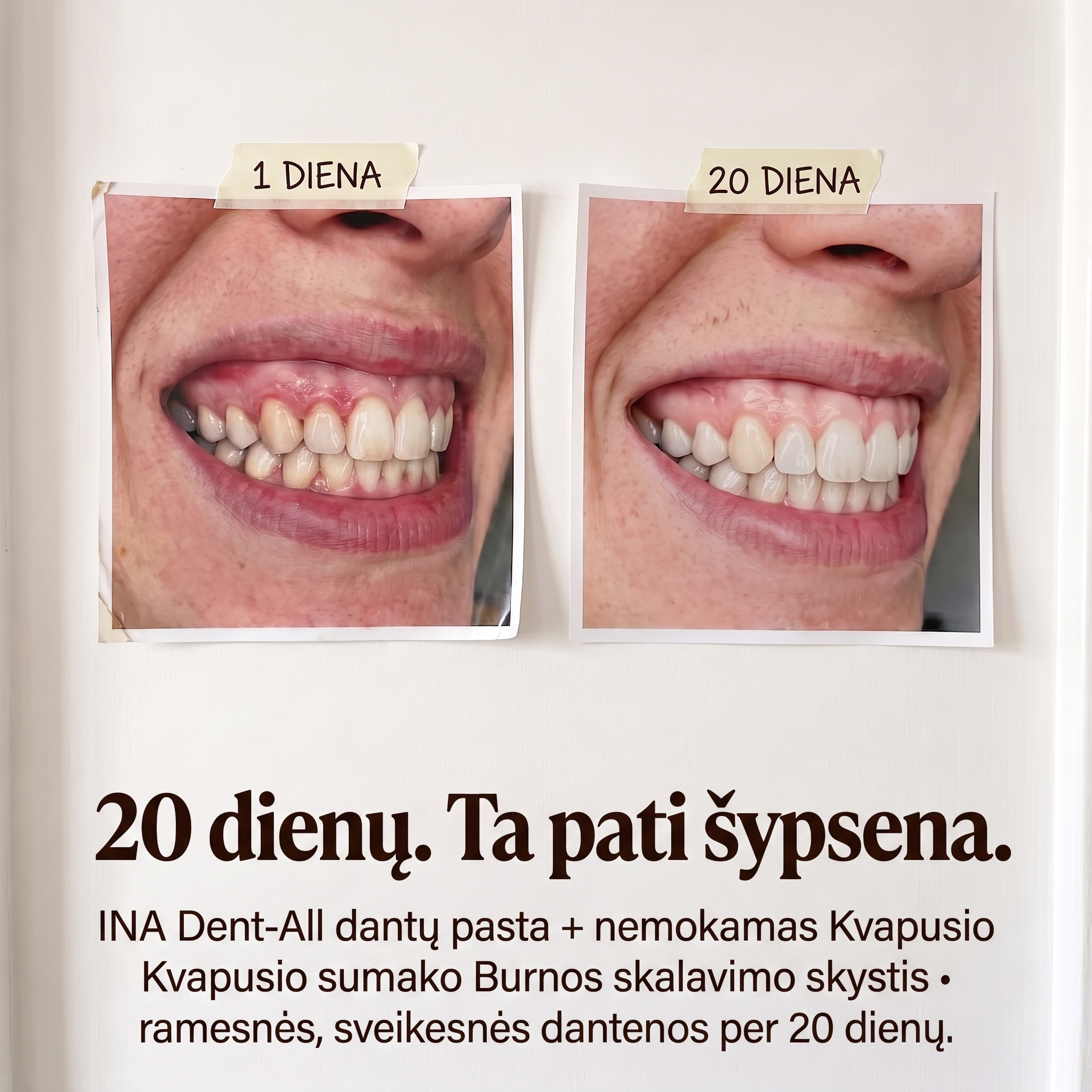 Organinė Kosmetika - InaEssentials.LT Facebook ad: Ta pati šypsena. Ramesnės dantenos per 20 dienų.
