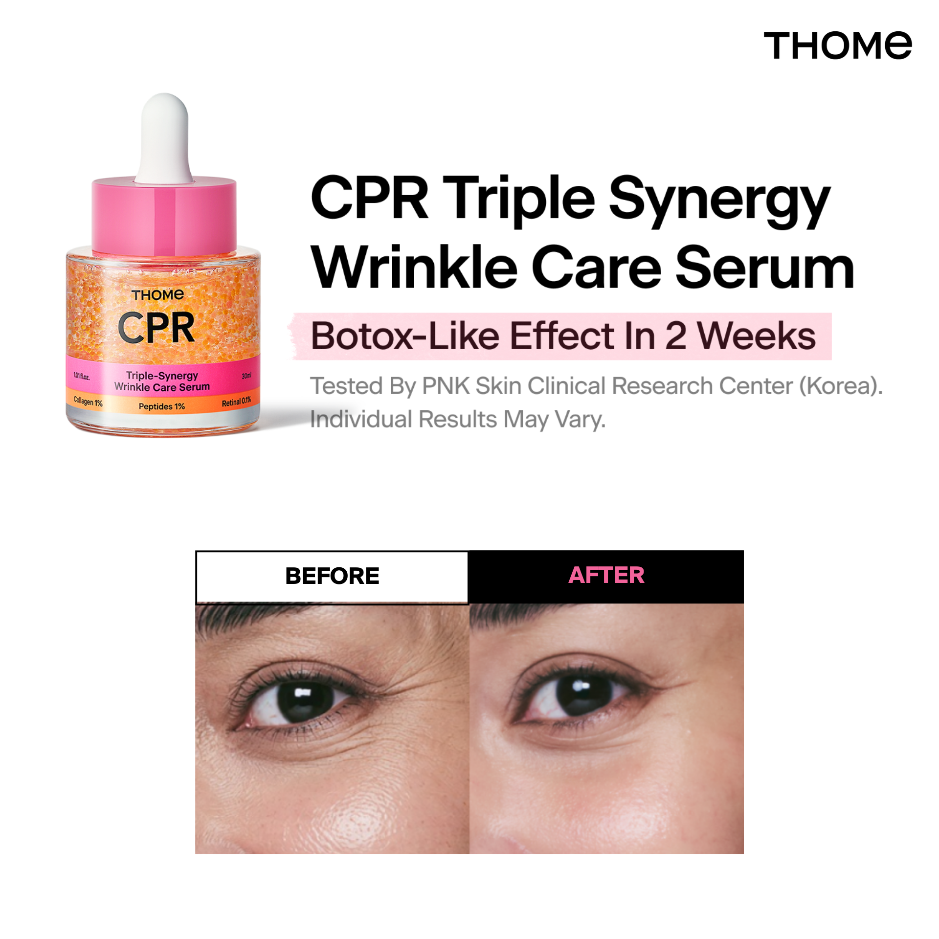 THOME Global Facebook ad: THOME CPR Serum - Collagen 1% + Peptide 1% + Retinal 0.1%…