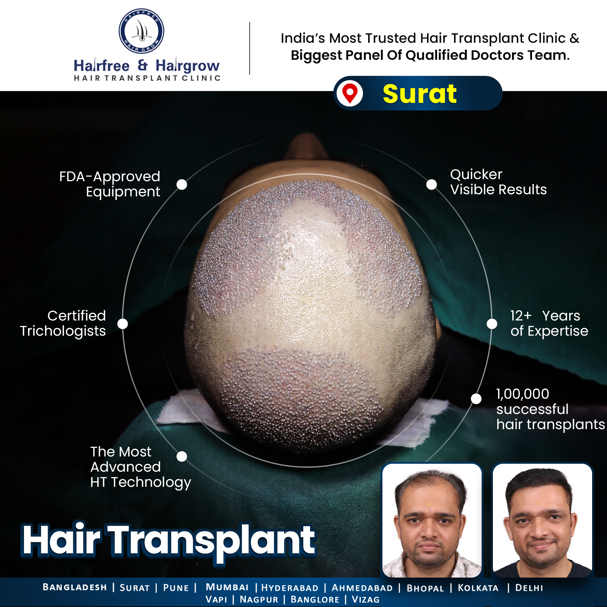 Hairfree Hairgrow Clinic Facebook ad