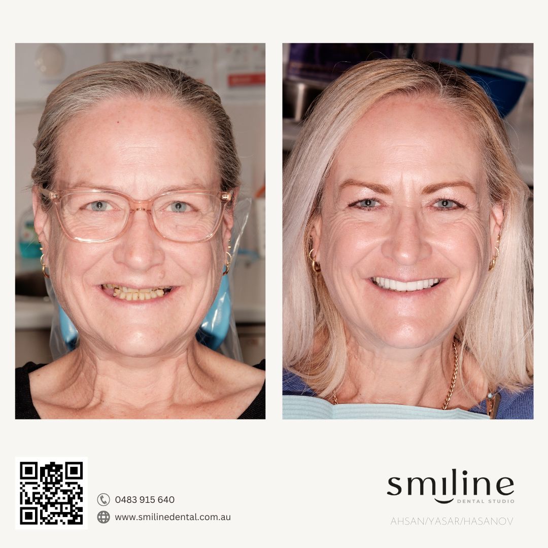 Smiline Dental Facebook ad