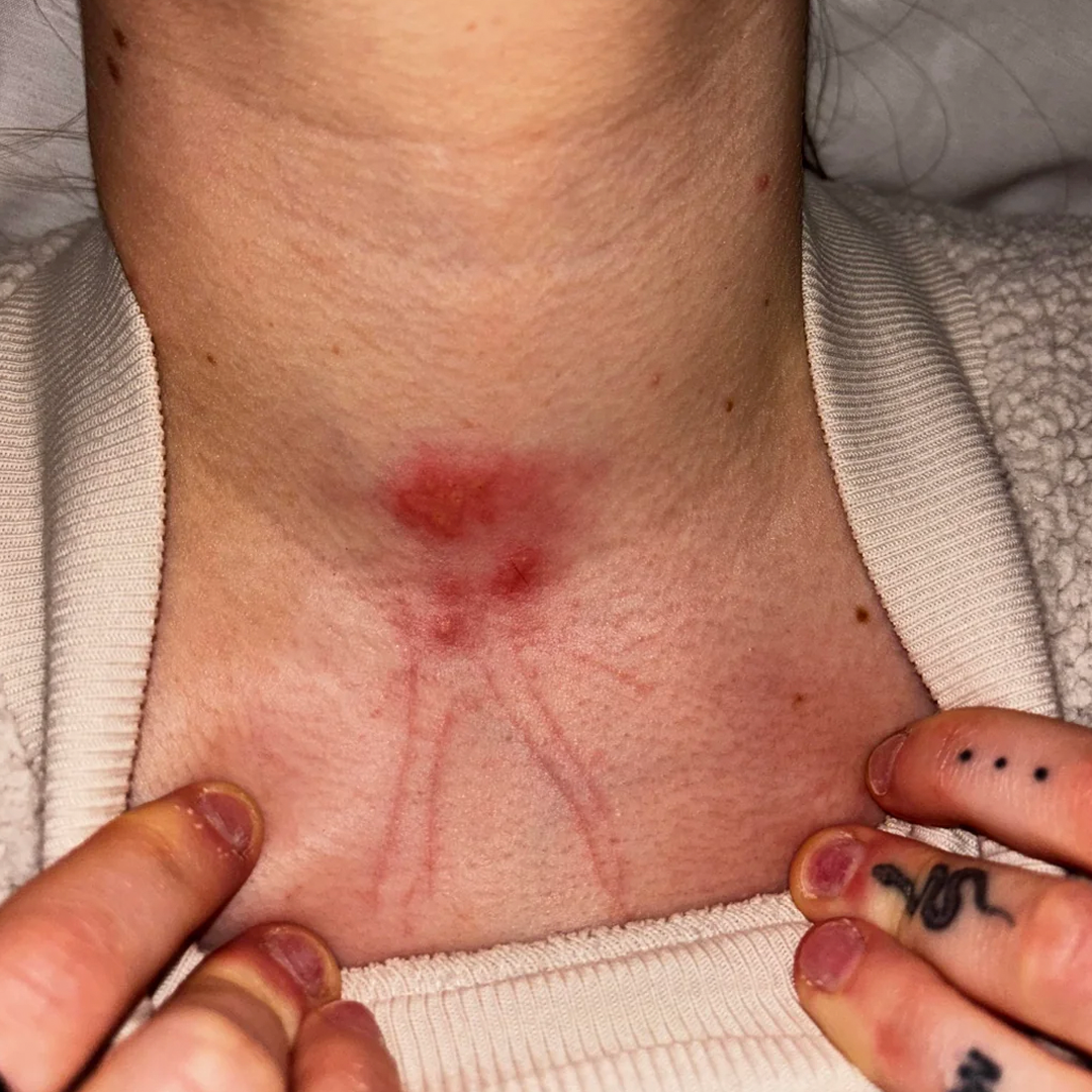 The Thyroid Health Project Facebook ad: To the woman with Hashimoto's whose bloodwork is normal…
