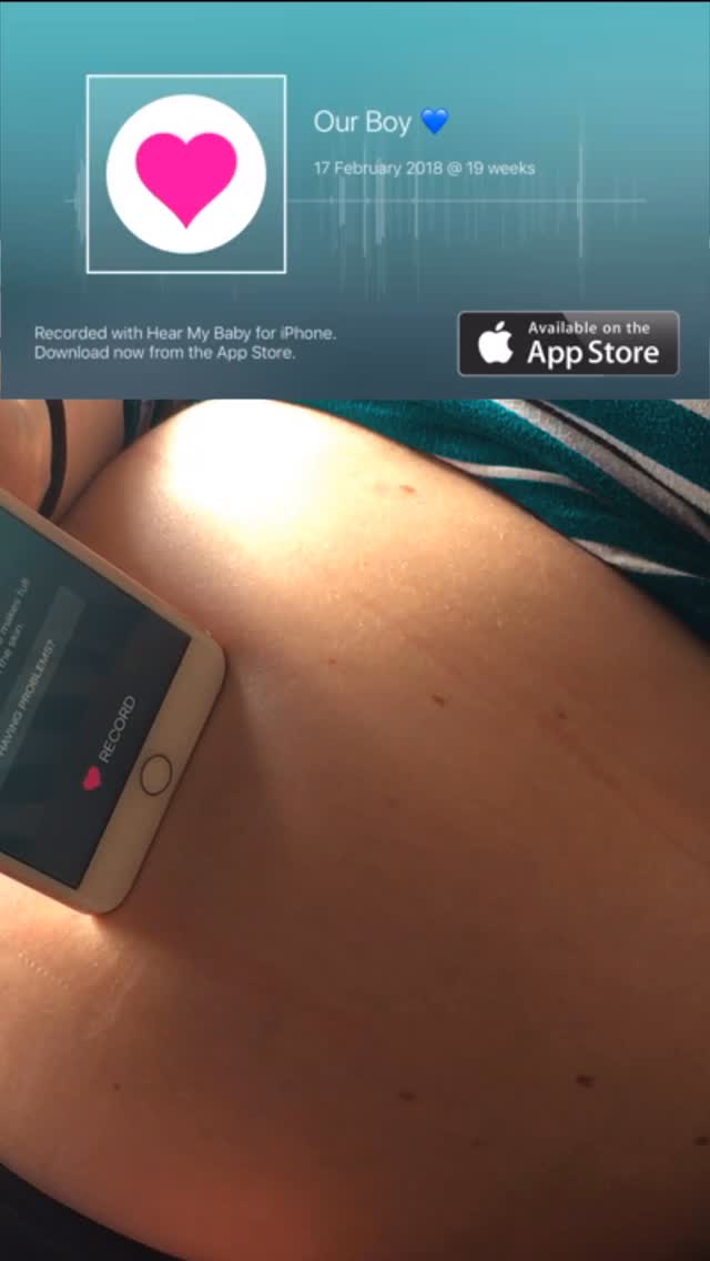 Hear My Baby - Heartbeat Monitor Pregnancy App Facebook ad from Mar 7, 2026