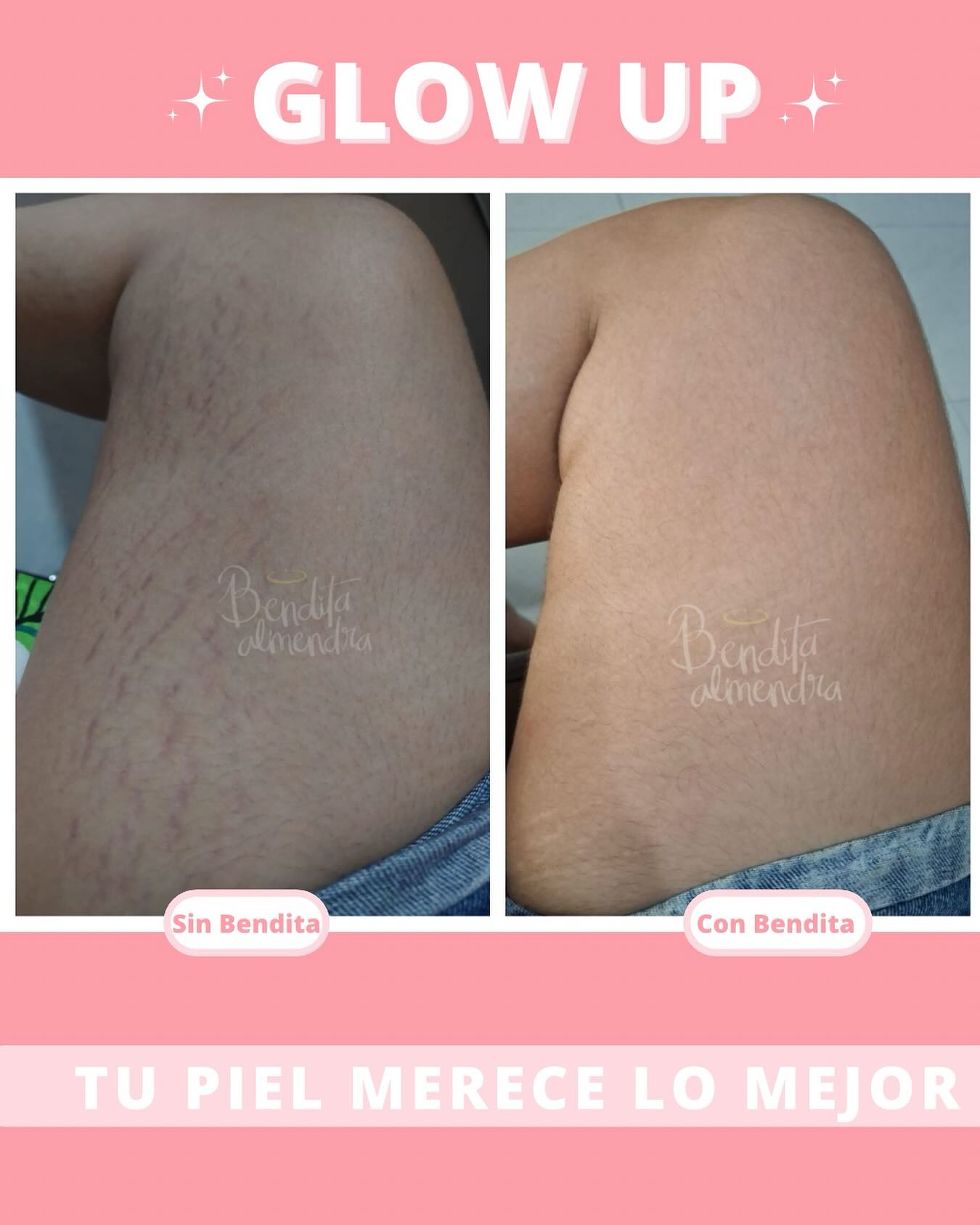 Bendita Almendra Facebook ad: ¿Qué esperas para comenzar tu tratamiento anti-estrías?
