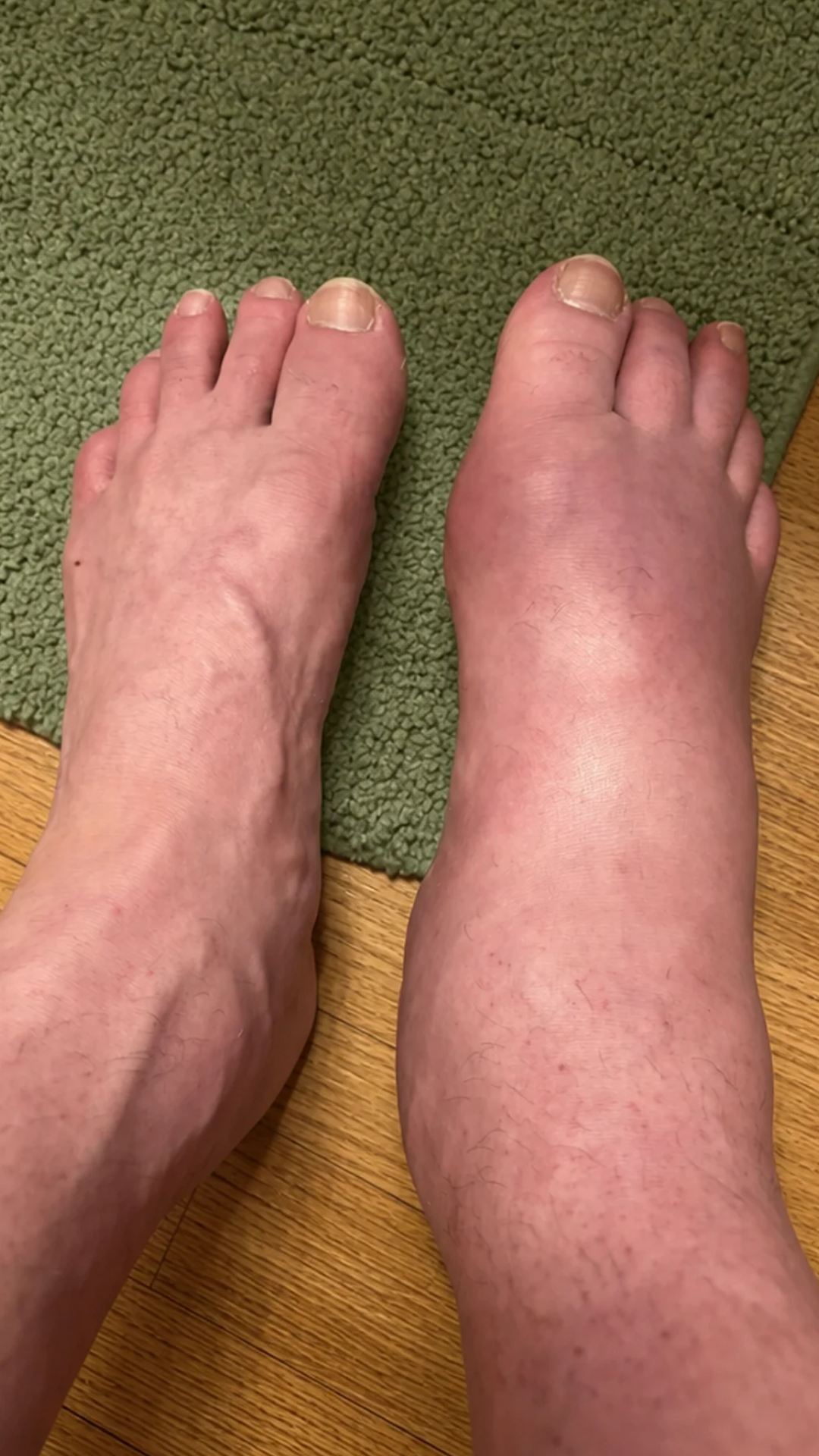 Dr. Daniel Miller Facebook ad: Everyone with gout flare-ups needs to see this