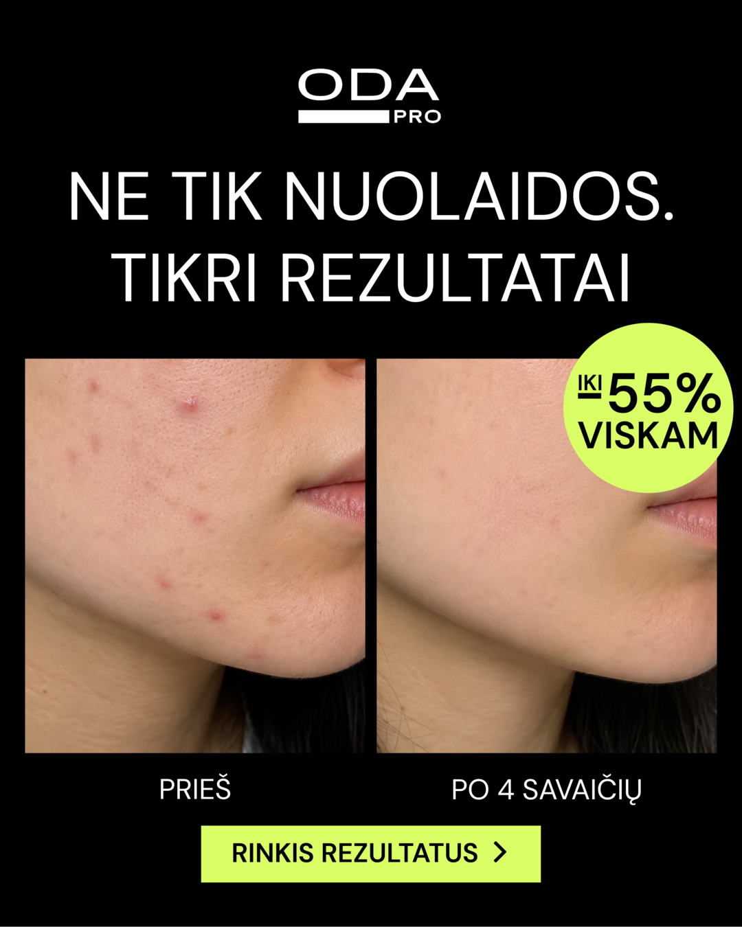ODA PRO Facebook ad