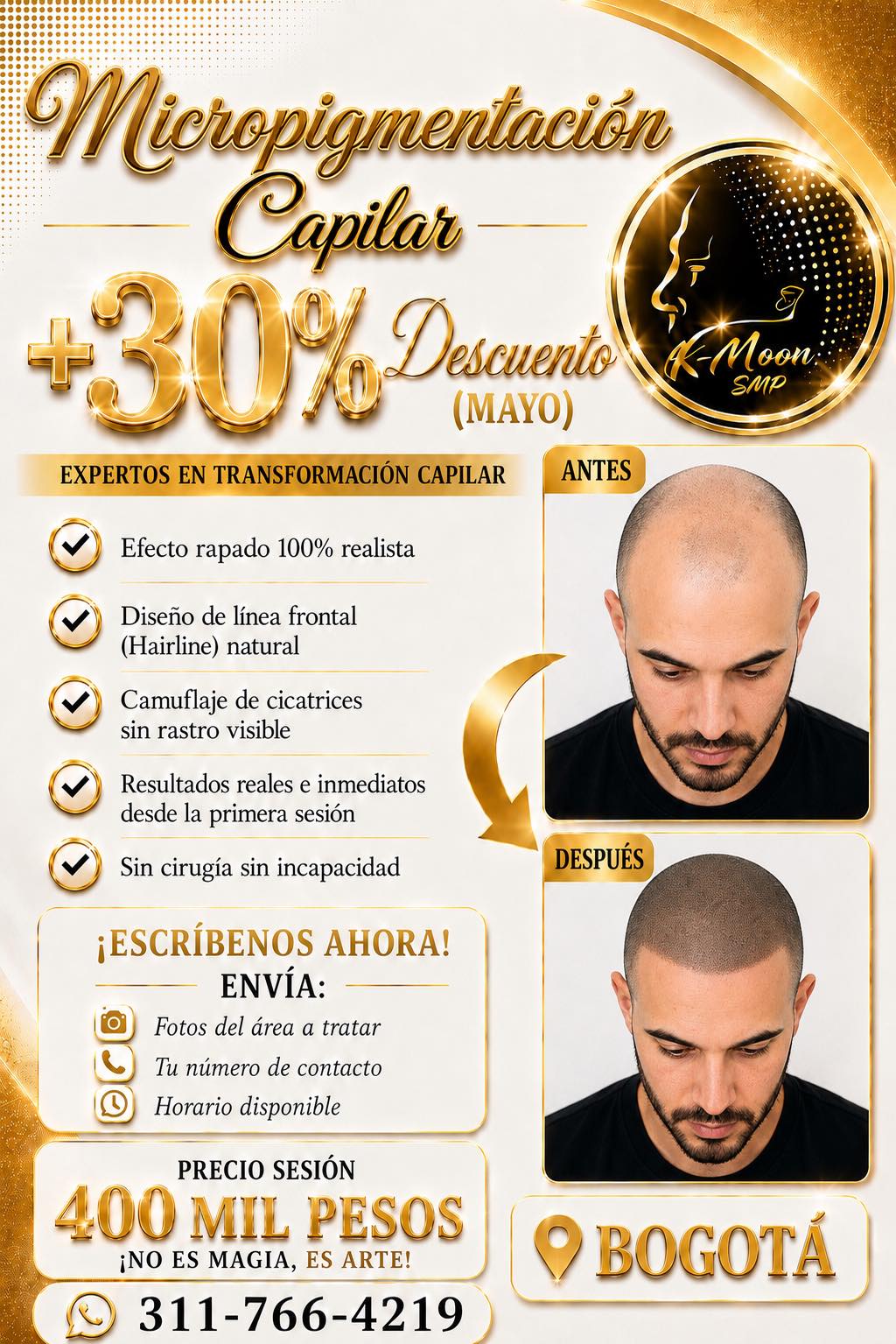 KMOON SMP Facebook ad: SOLUCIÓN # 1 - CONTRA LA CALVICIE