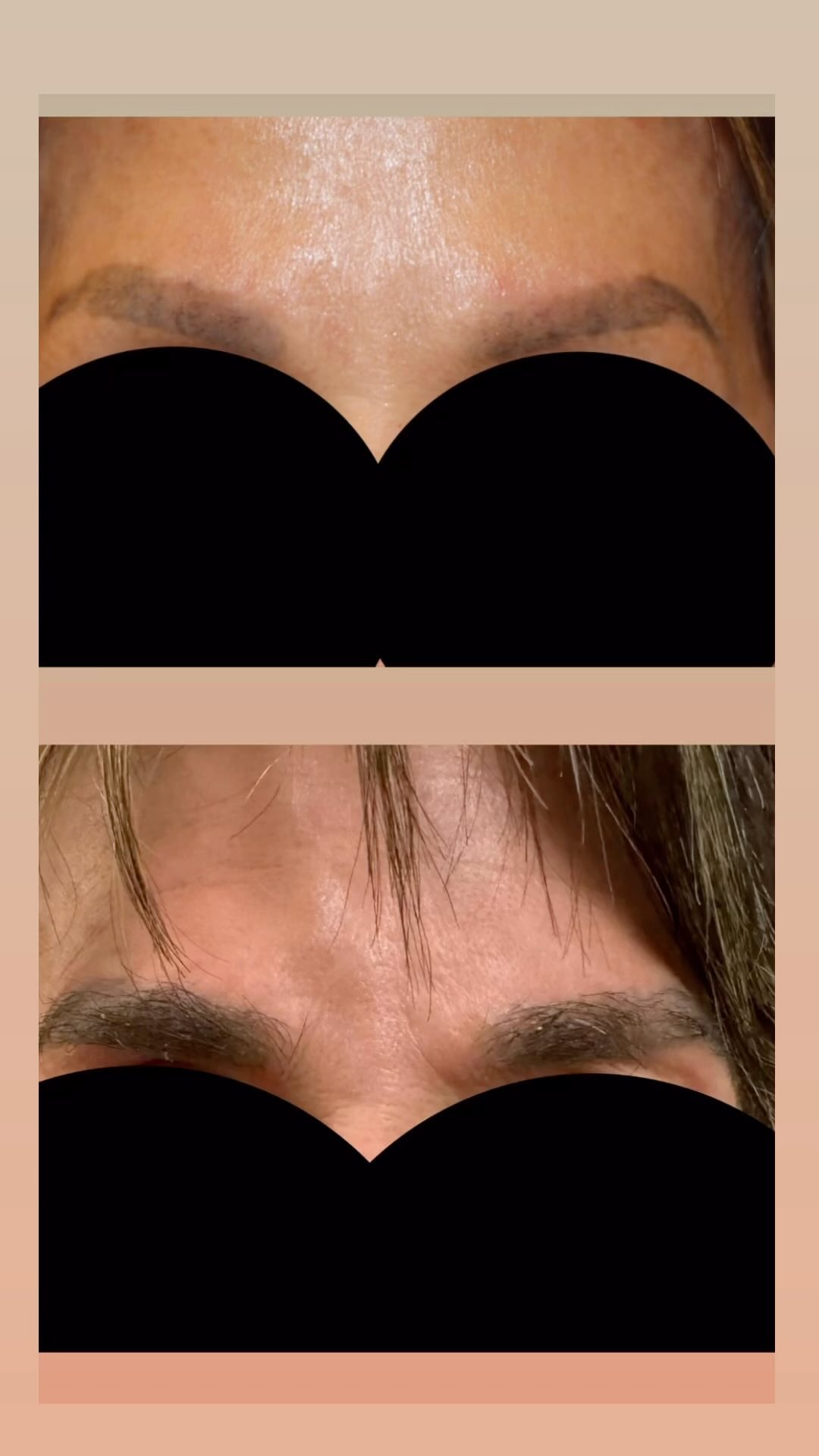 Modena Hair Institute Facebook ad: Christmas came early for our lovely patient who…