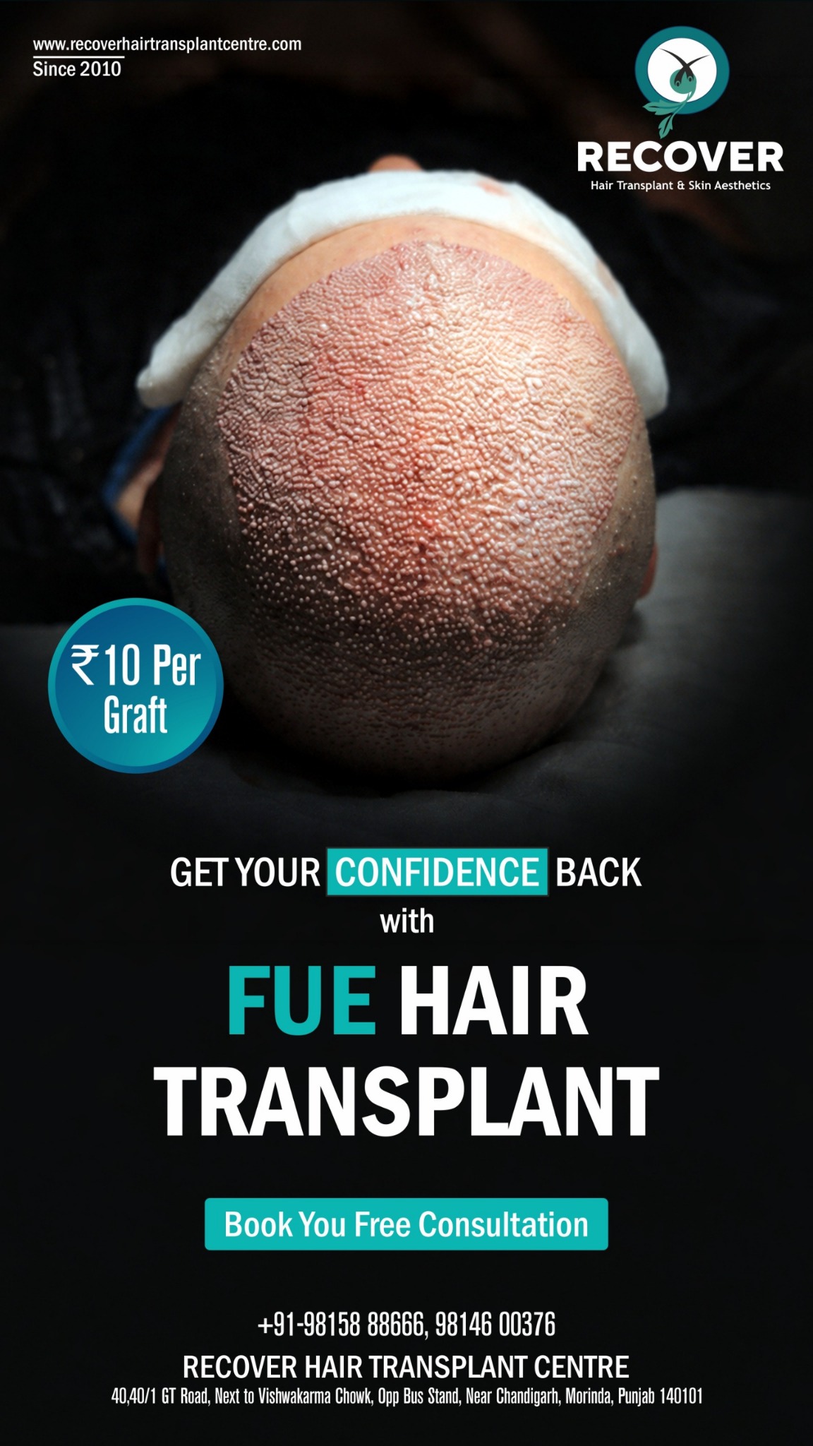 Recover Hair Transplant Centre Facebook ad from Apr 16, 2026