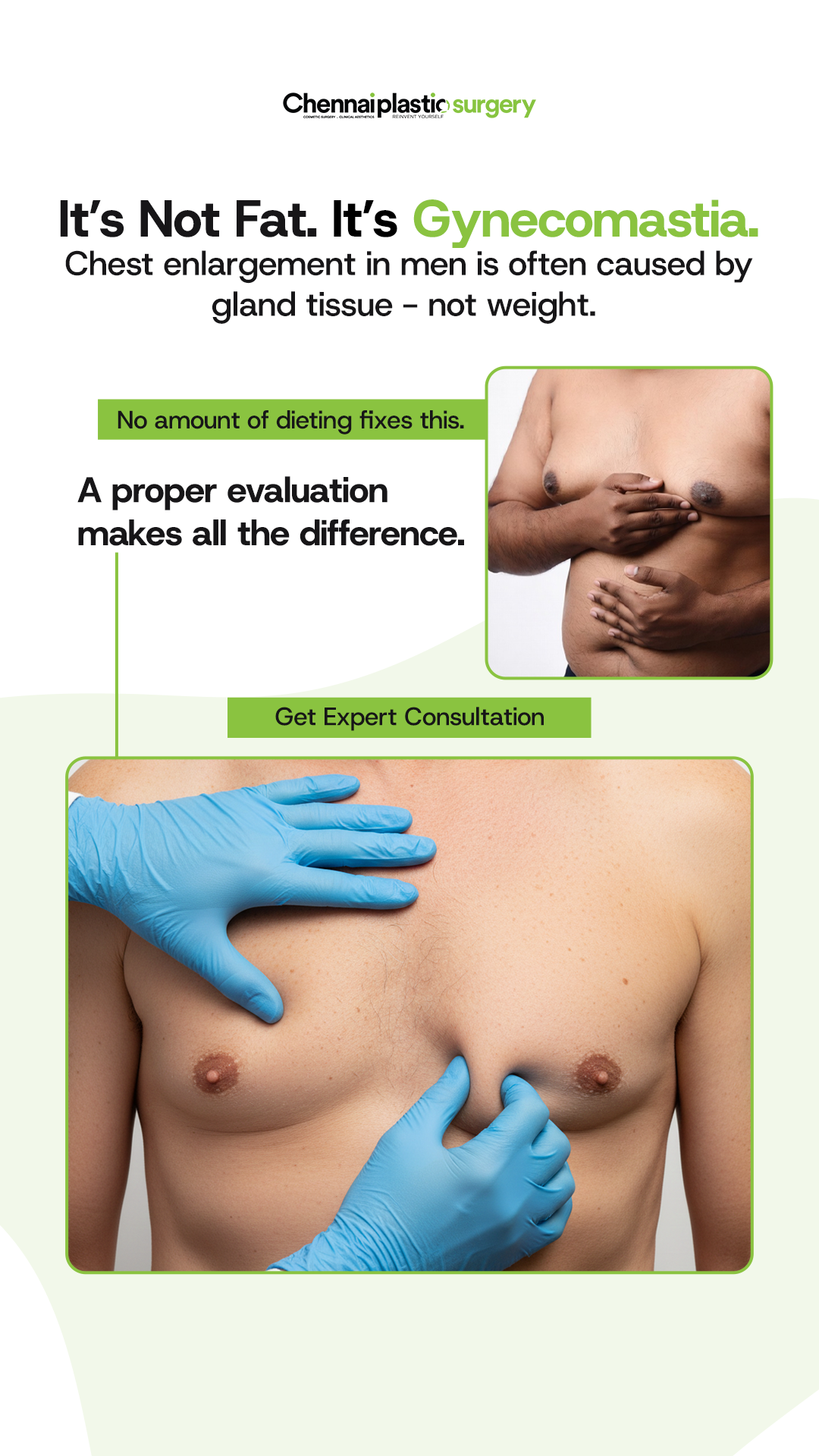 Chennai Plastic surgery Facebook ad