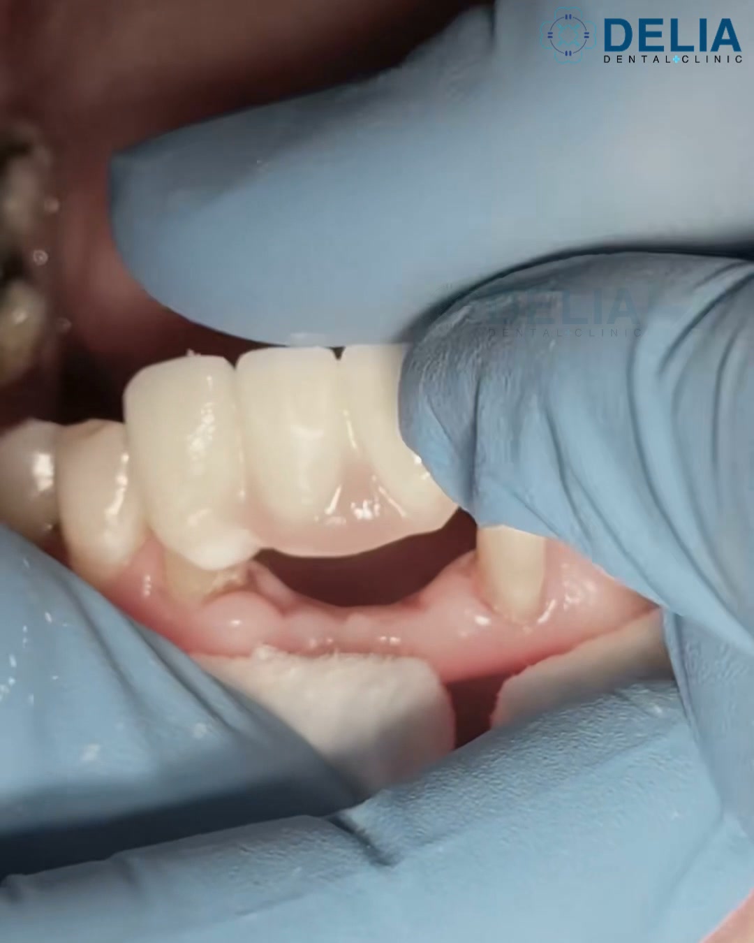 Delia Dental Clinic Facebook ad: FREE consultation today