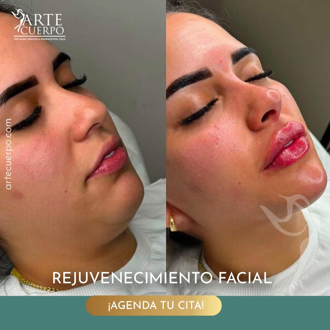 Clinica spa arte cuerpo  Facebook ad