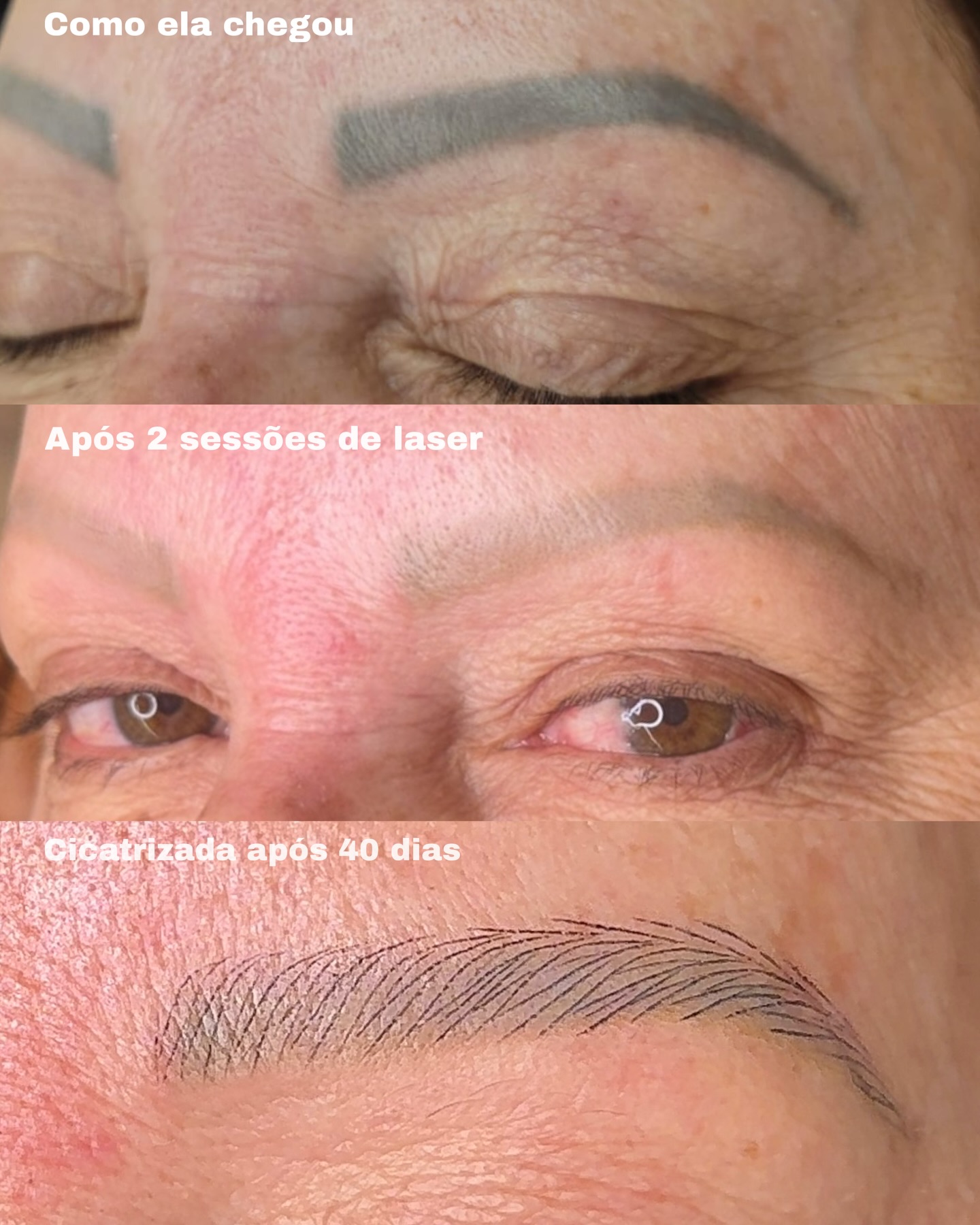 Adara Nogueira - Micropigmentação - PMU Artist Facebook ad: Ela chegou com uma micropigmentação antiga, feita por…