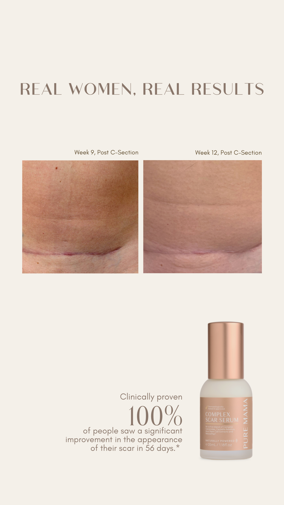 PURE MAMA Skincare Facebook ad