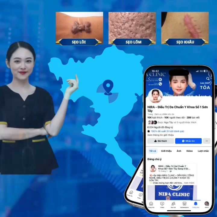 NIRA - Điều Trị Da Chuẩn Y Khoa Số 1 Sơn Tây Facebook ad: NGẠC NHIÊN VỚI KẾT QUẢ ĐIỀU TRỊ S.E.O…