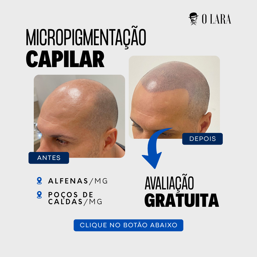 Jônatas Lara Especialista em Saúde Capilar Facebook ad: Converse conosco