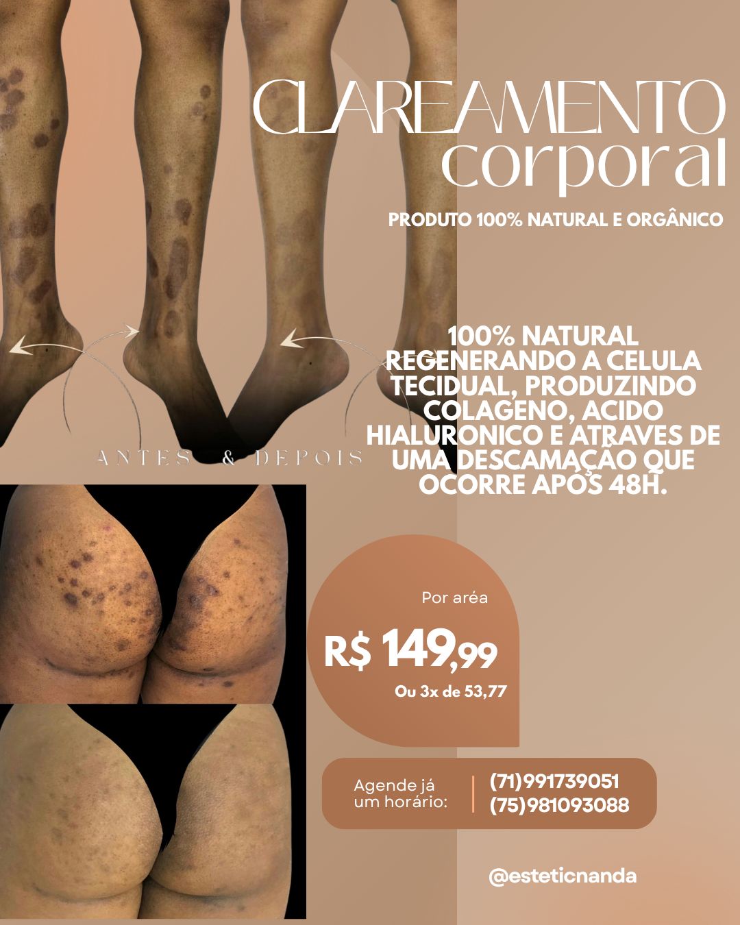 Nanda Estética Facebook ad: GARANTA SUA PROMOÇÃO AGORA MESMO!
