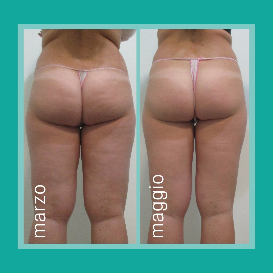 Veronica Equipe Centro Dimagrimento Facebook ad