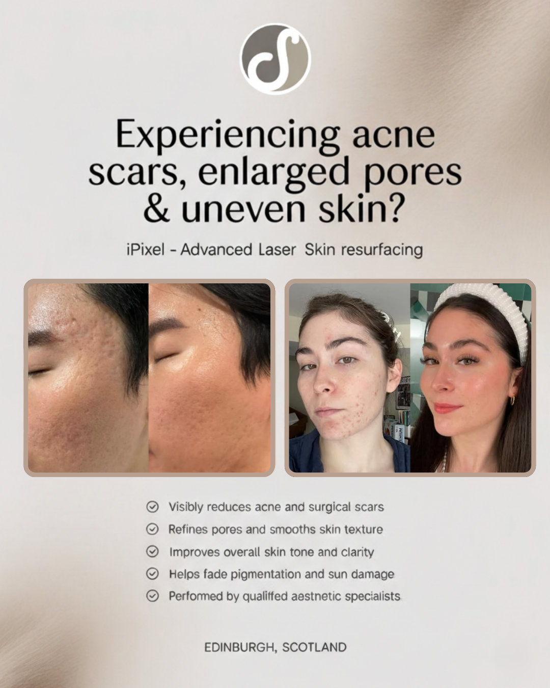Soprano ICE Edinburgh Facebook ad: Up to 30% OFF Advanced Laser Skin Renewal