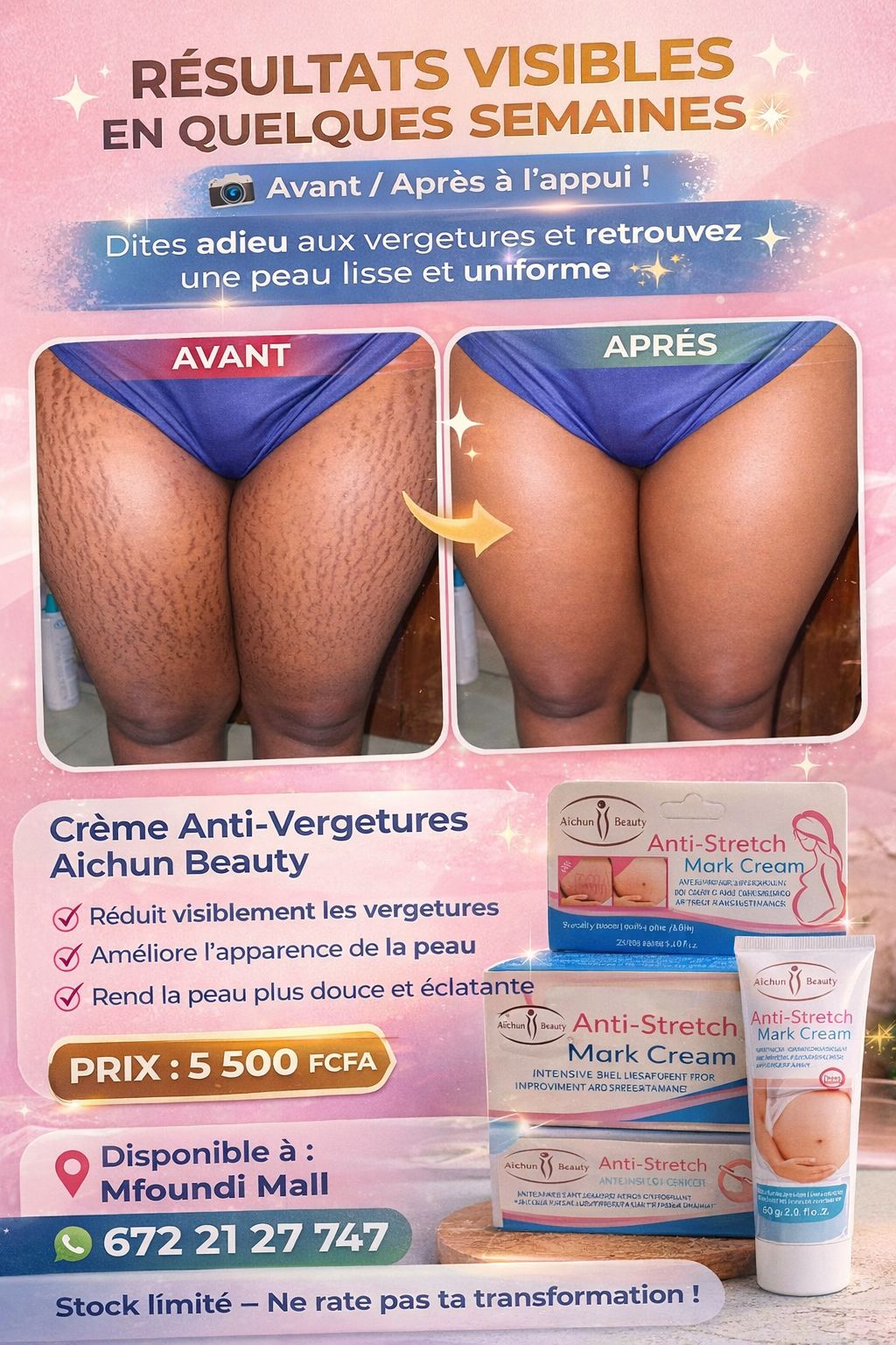 Solange beauty Facebook ad: Promotion gamme teint clair 7500fcfa et la livraison…