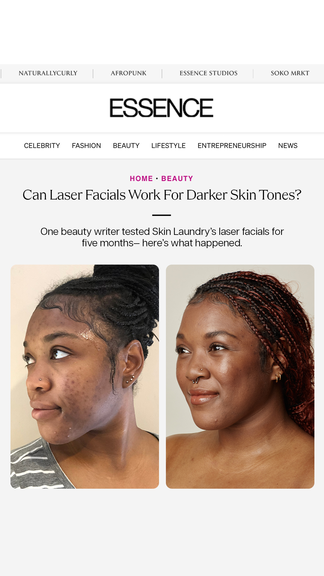 Skin Laundry Facebook ad