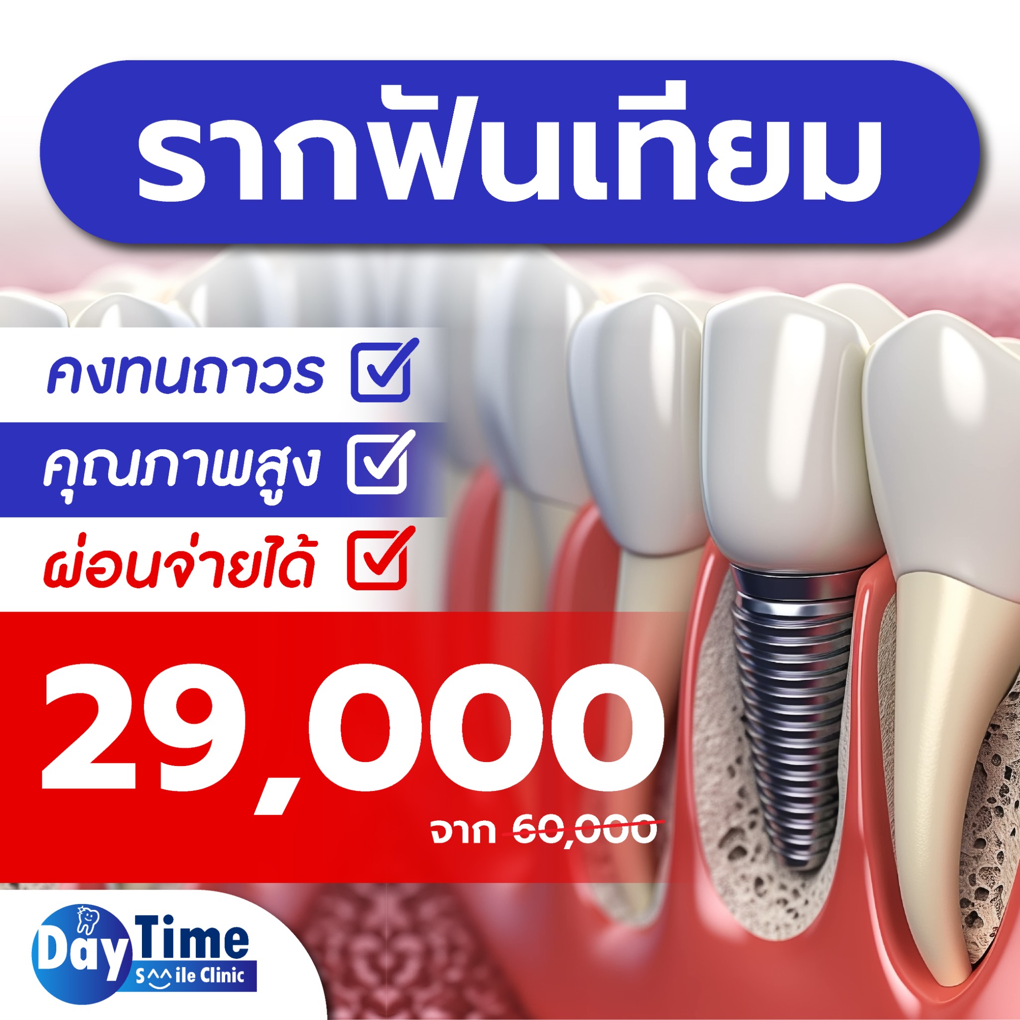 แหล่งรวมโปรรากฟันเทียม สุดคุ้ม Facebook ad: ราคาถูกทำโดย อาจารย์หมอเฉพาะทาง