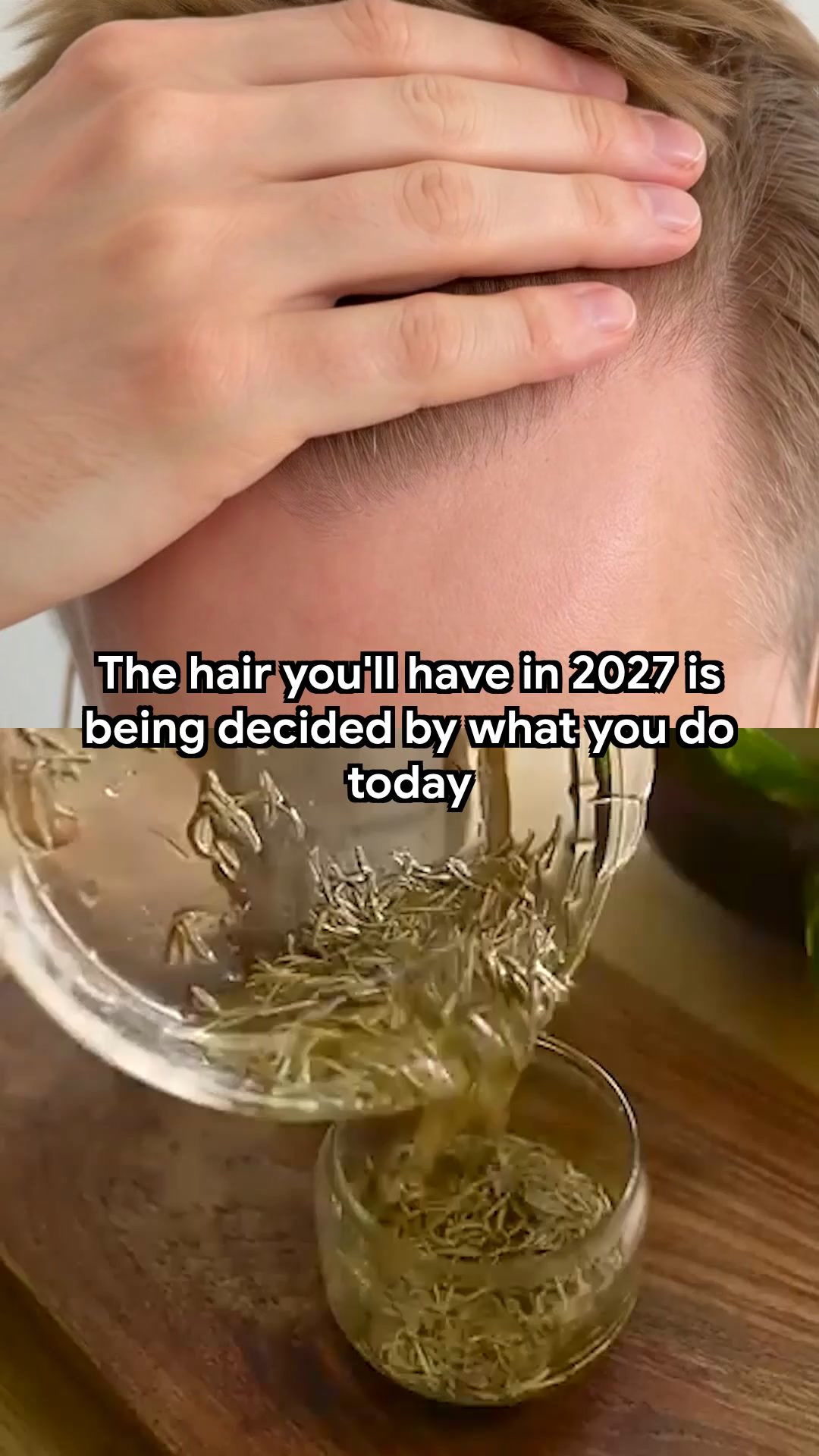 Scandinavian Biolabs Facebook ad: Next Year's Hairline Is Decided Now