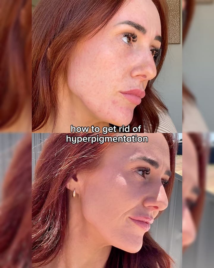 Hey Bud Facebook ad: Fade Hyperpigmentation Naturally
