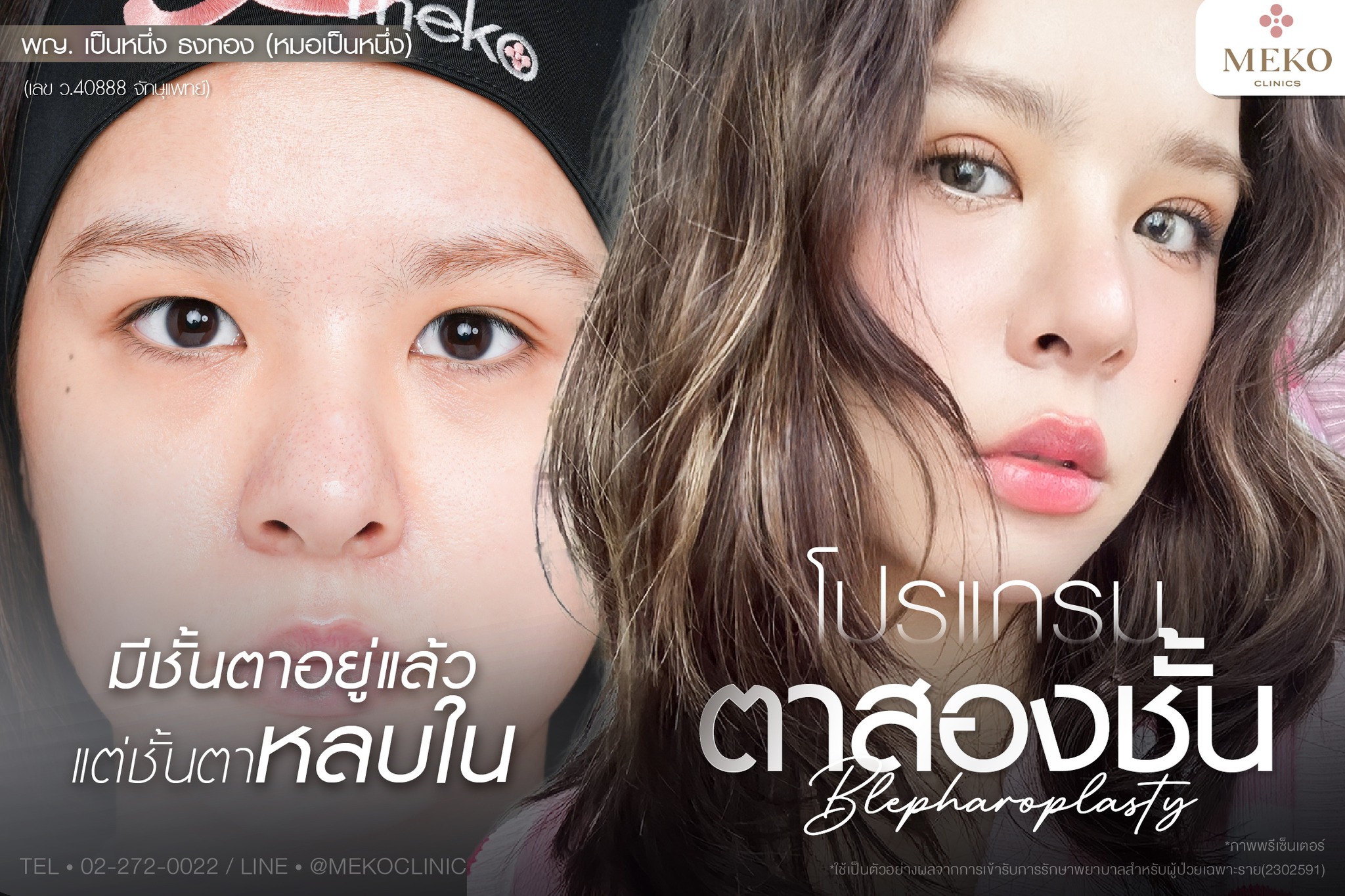 Meko Hospital โรงพยาบาล เมโกะ Facebook ad: เทคนิค Diamond Fix ปรับแต่งหนังตา ปรับแต่งไขมันเปลือกตา…