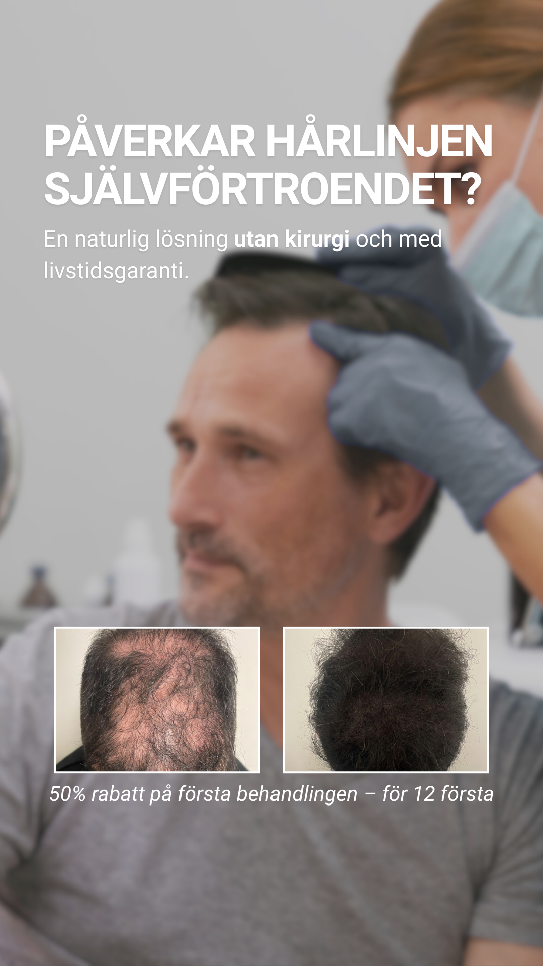 Scalp Micropigmentation Capillos Facebook ad from Mar 16, 2026