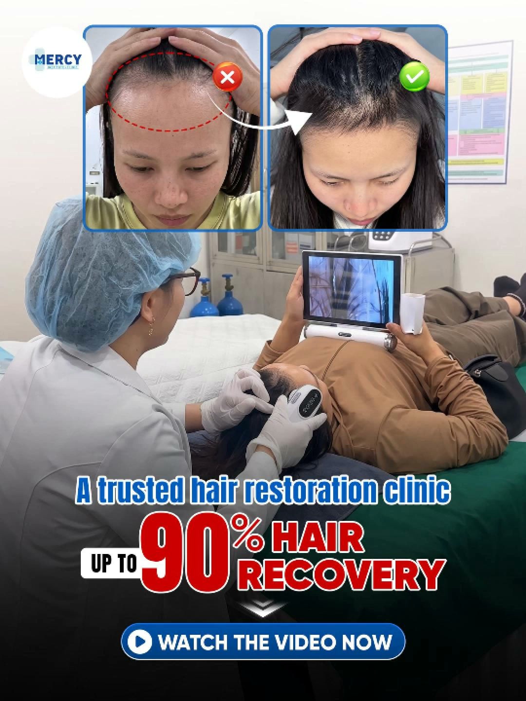 Mercy Hair Growth in the Davao Facebook ad: LOOKING FOR 99 WOMEN EXPERIENCING POSTPARTUM OR HORMONAL…