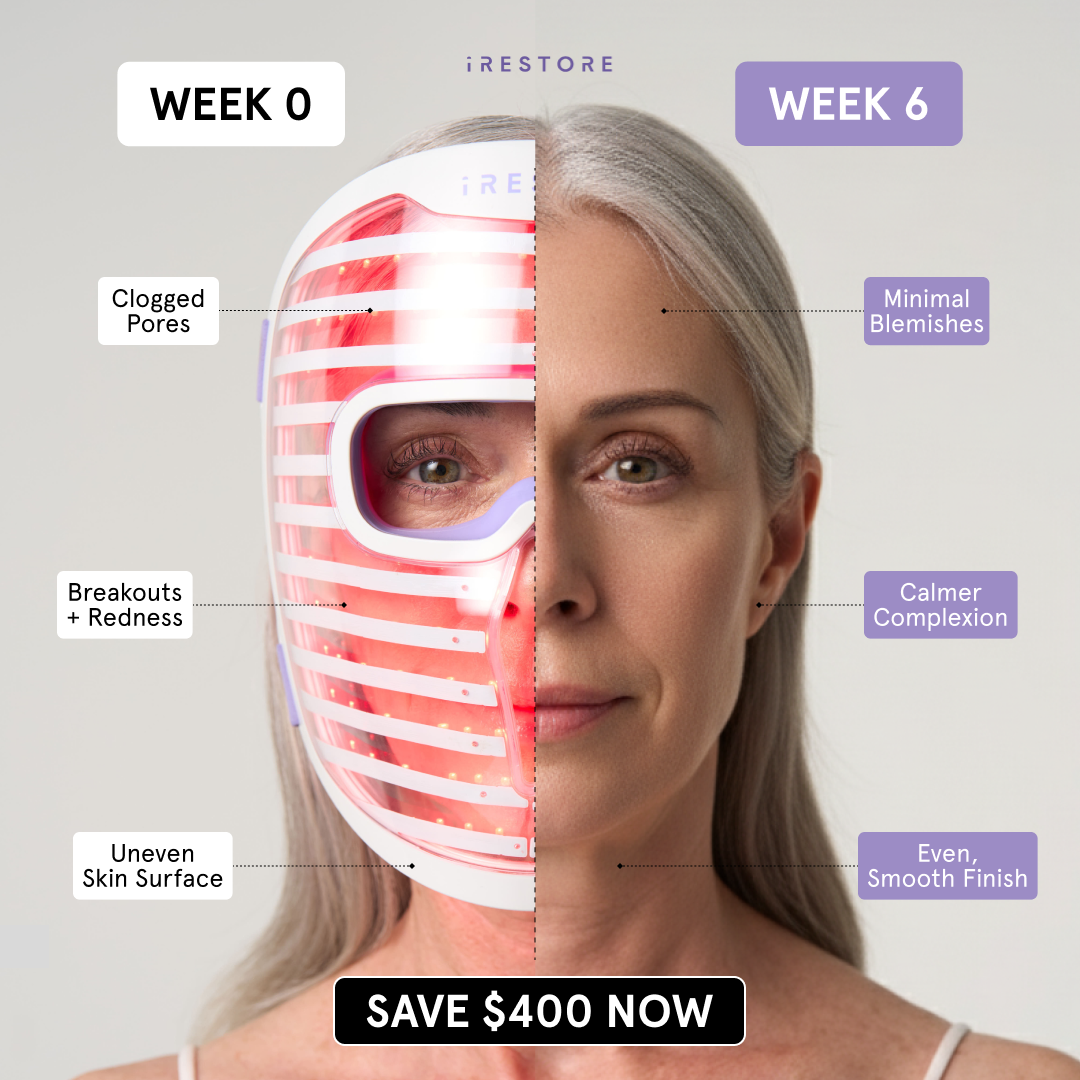 Wellness Rewired Facebook ad: The iRESTORE Illumina Face Mask is Superior!