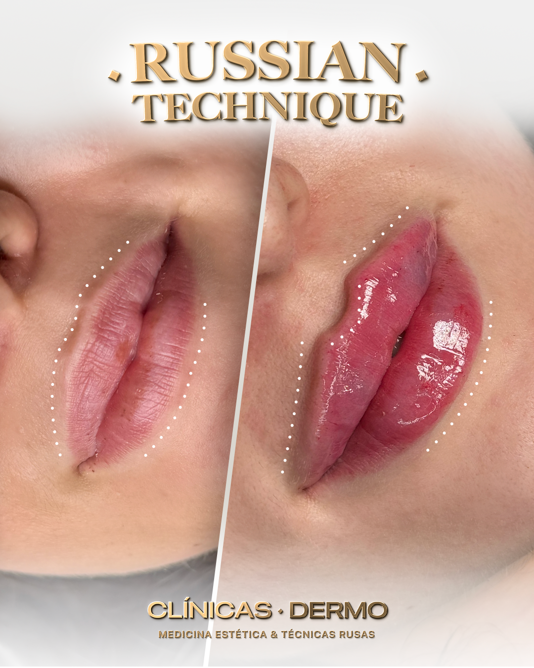 Dermo Clinic Chorbadzhyiiska Facebook ad