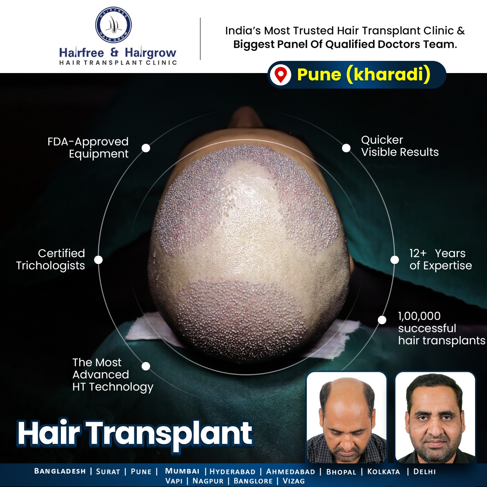 Hairfree Hairgrow Clinic Facebook ad
