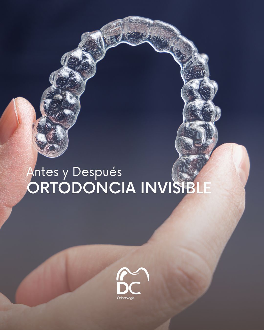 Odontología DC Facebook ad: Antes y Después de ortodoncia con alineadores invisibles…