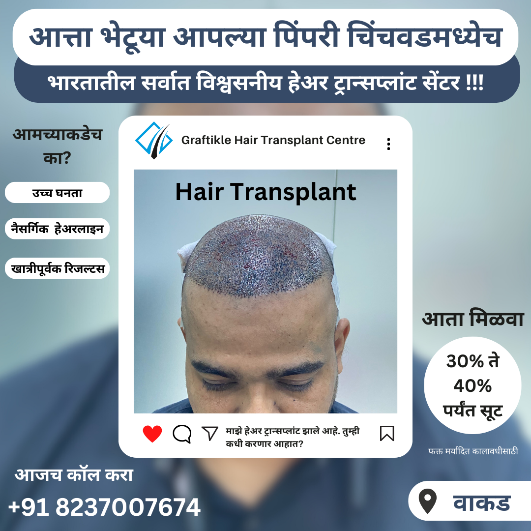 Graftikle Hair Transplant Center Facebook ad