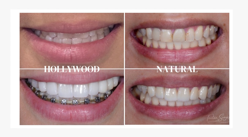 Pampanga Dentist by Smile Precision Dental Clinic Facebook ad: Us Here or set a schedule