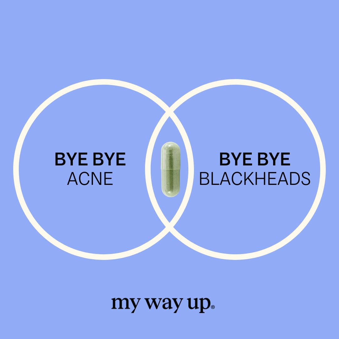 Mywayup Facebook ad