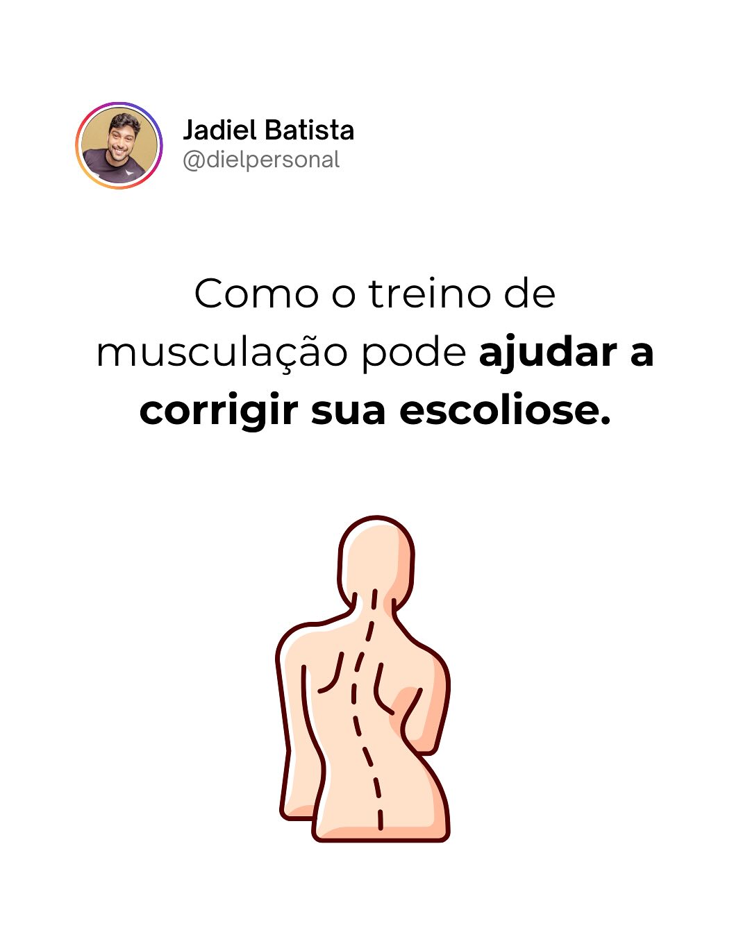 Jadiel Personal Facebook ad: Se você sofre por conta da escoliose, saiba…