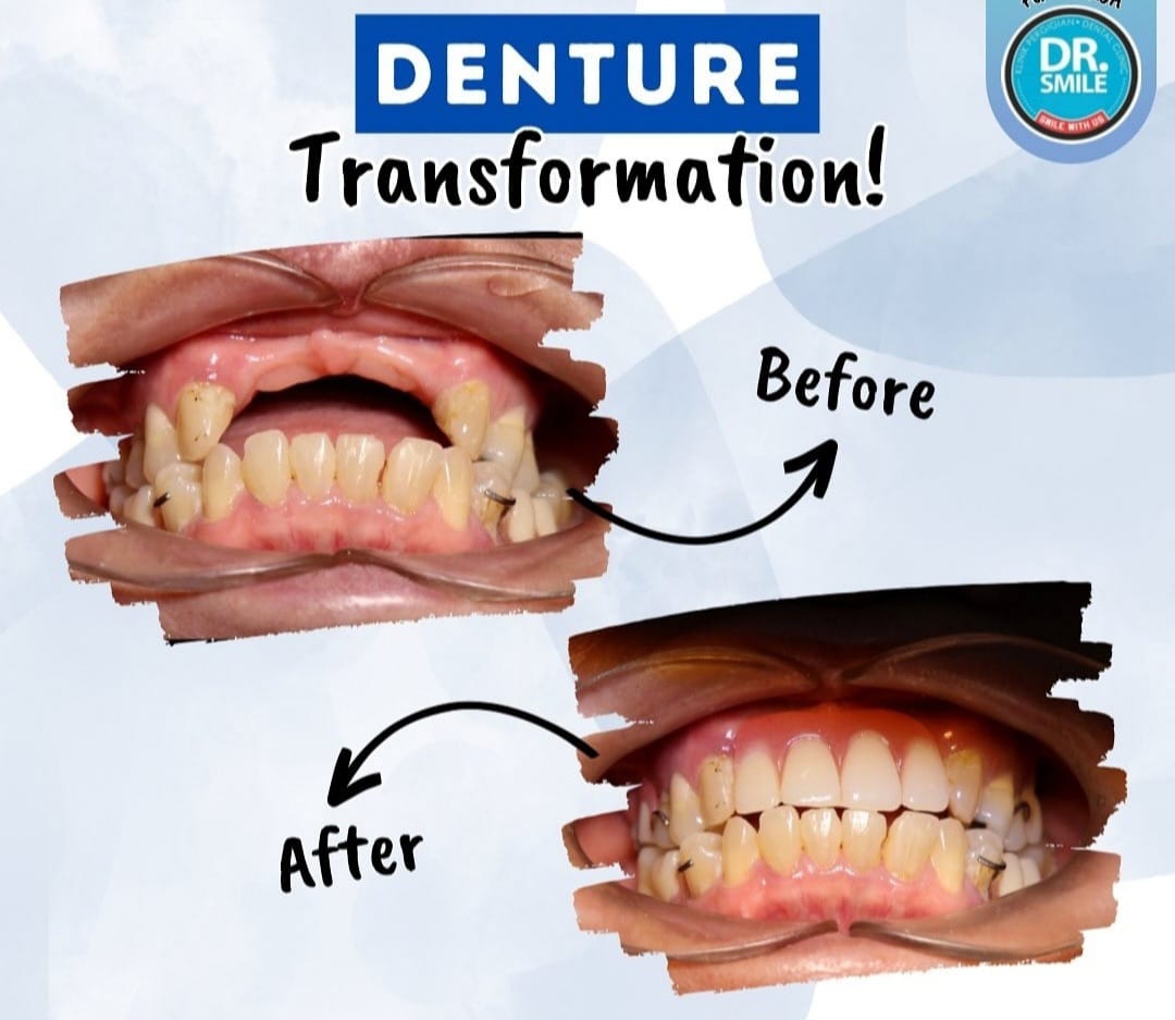 new smile Facebook ad: WhatsApp or phone