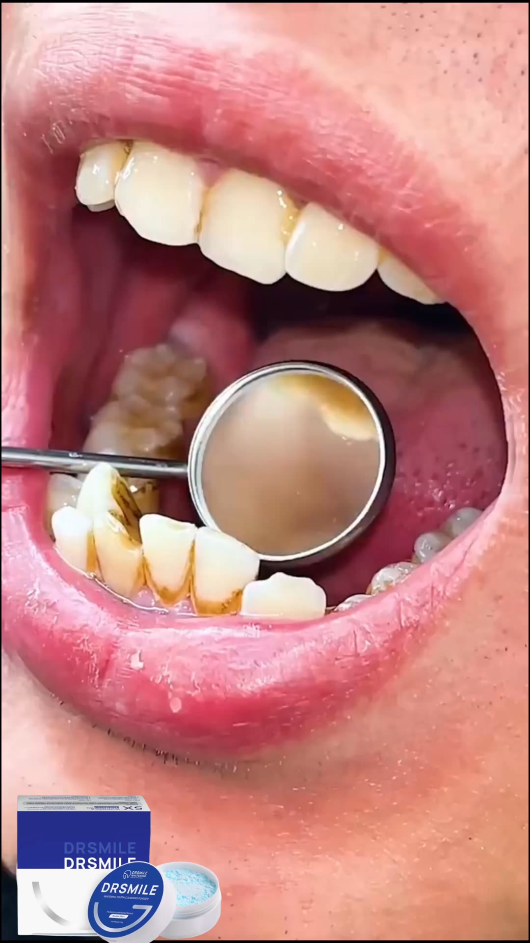 Dr Smile Whitening Facebook ad: 50家Pharmacy售卖 5年销量第一 卖出超过200千罐的牙粉