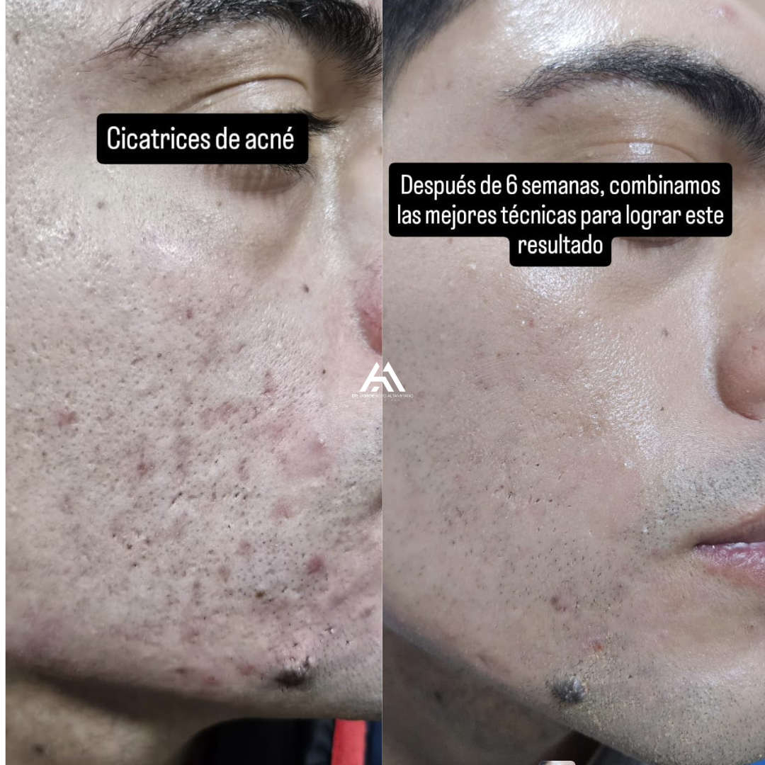 Dr Jorge Asto Dermatología Facebook ad