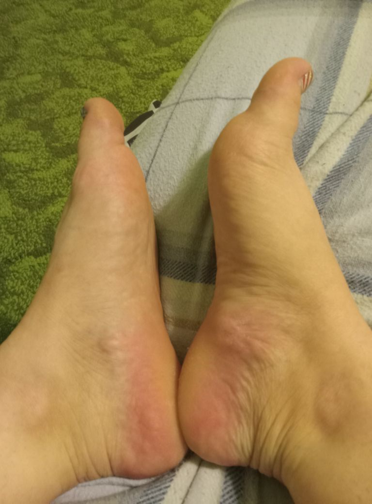 Laura Bennet Facebook ad: Top Physiotherapist Warns: Don’t Try Anything Else for…
