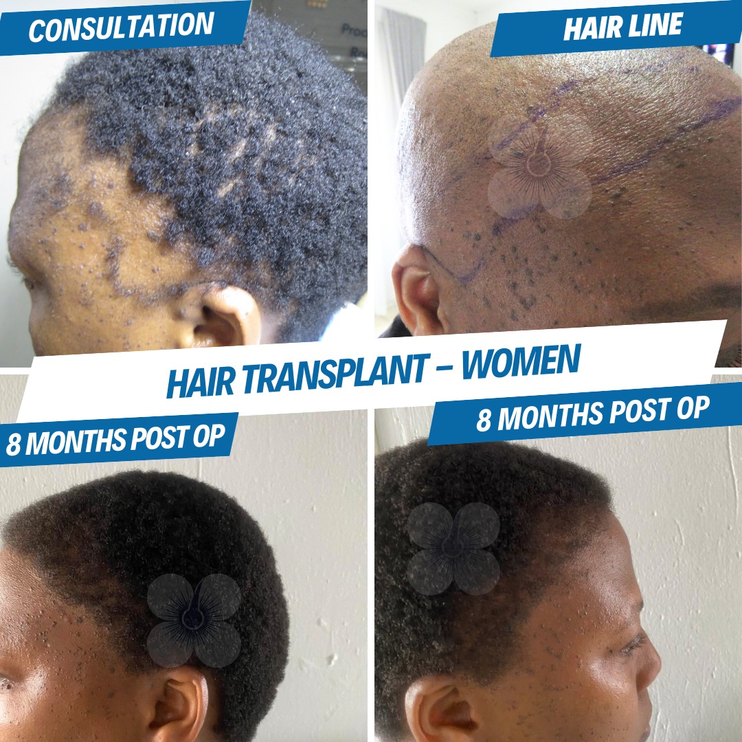 Hair Treatment Agency Rwanda Facebook ad
