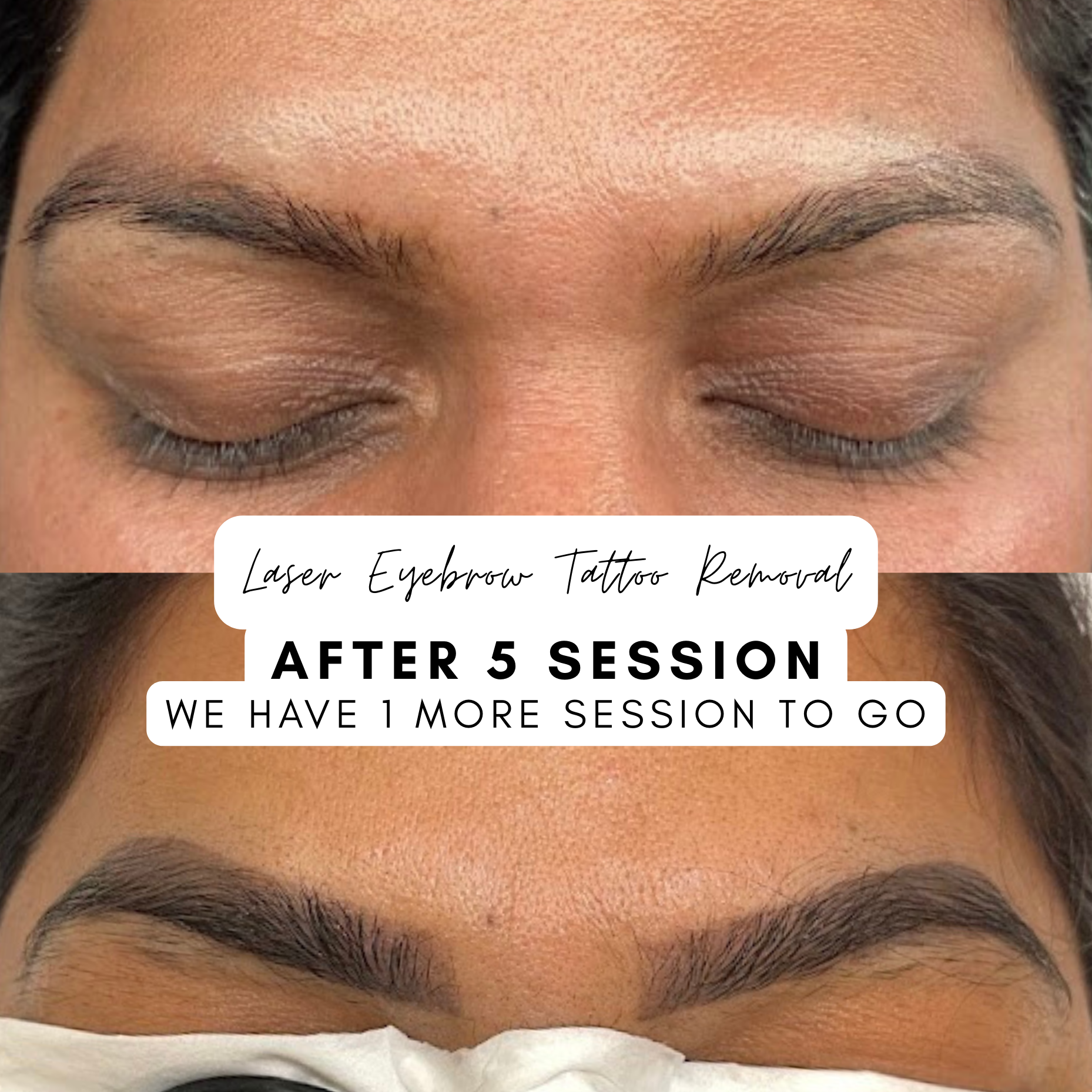 Roc Aesthetics Facebook ad