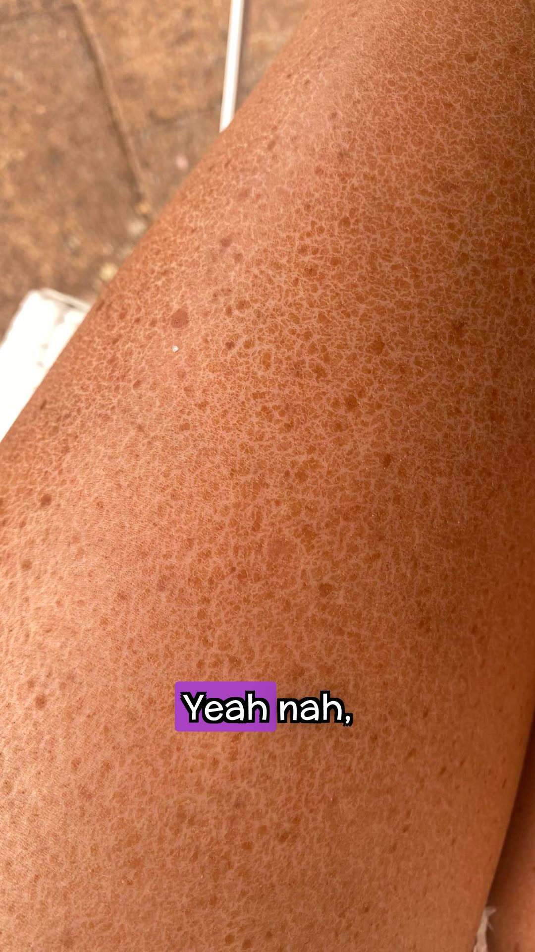 Miracle de Paris Facebook ad: Fake Tan is Rubbish if You've Got Sun Damage - Australian…