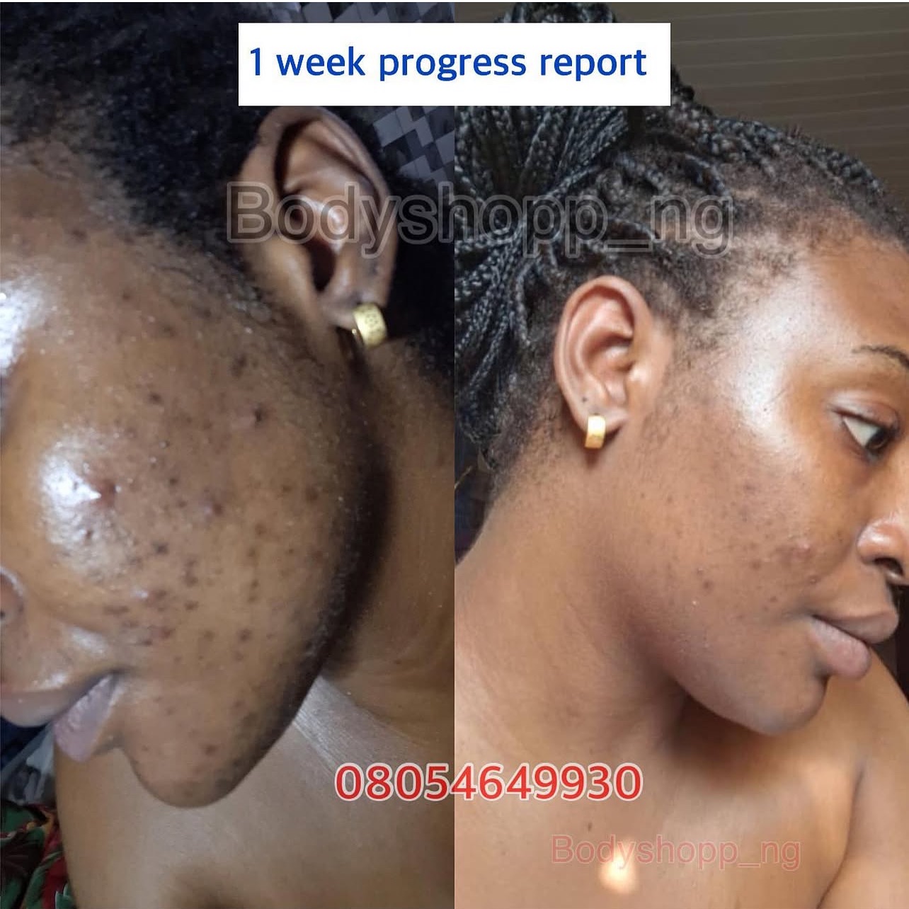 Bodyshoppng backup page Facebook ad: We love this amazing 1 week progress report…