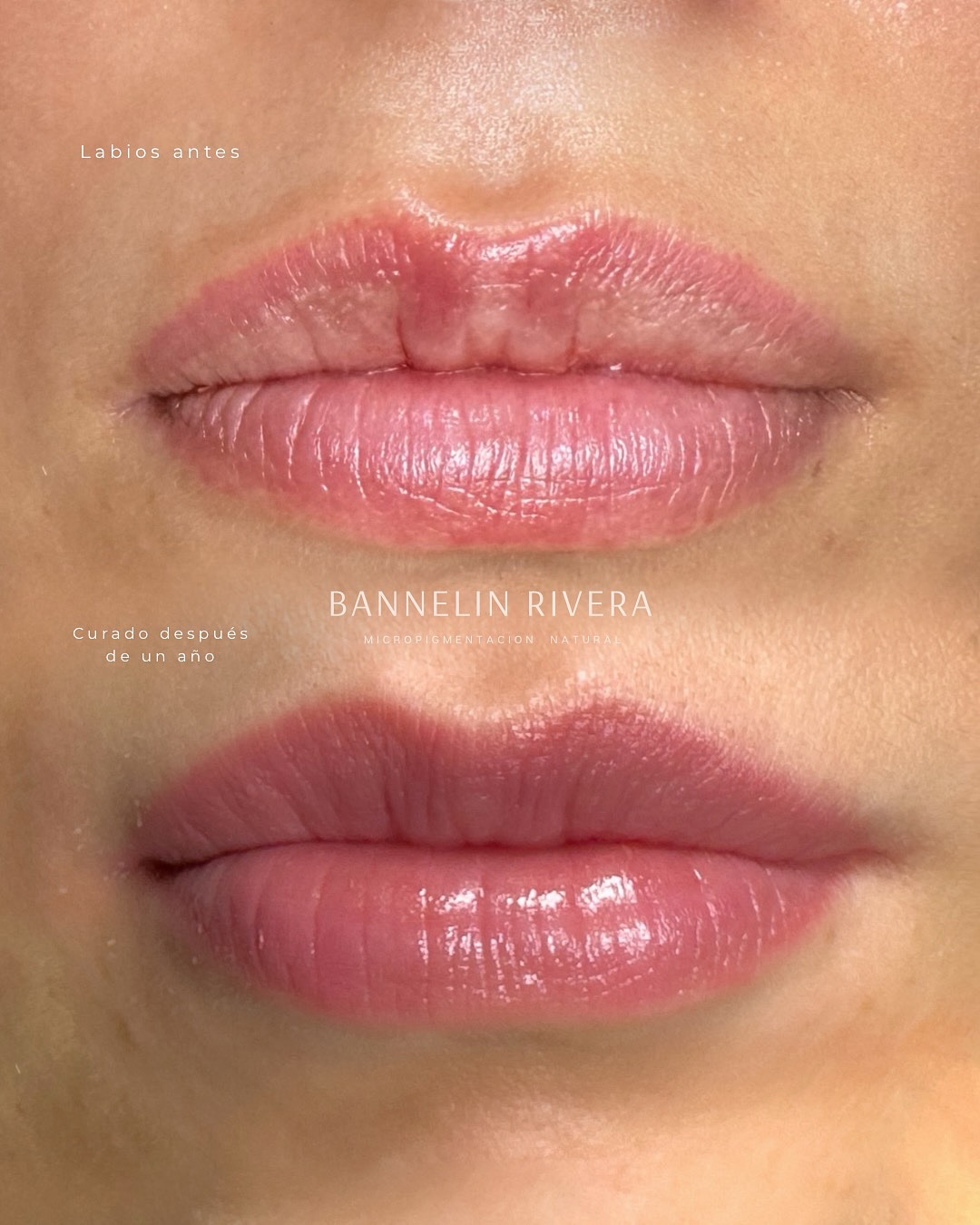 Bannelin Rivera Facebook ad: Micropigmentación en labios con gránulos de Fordyce…